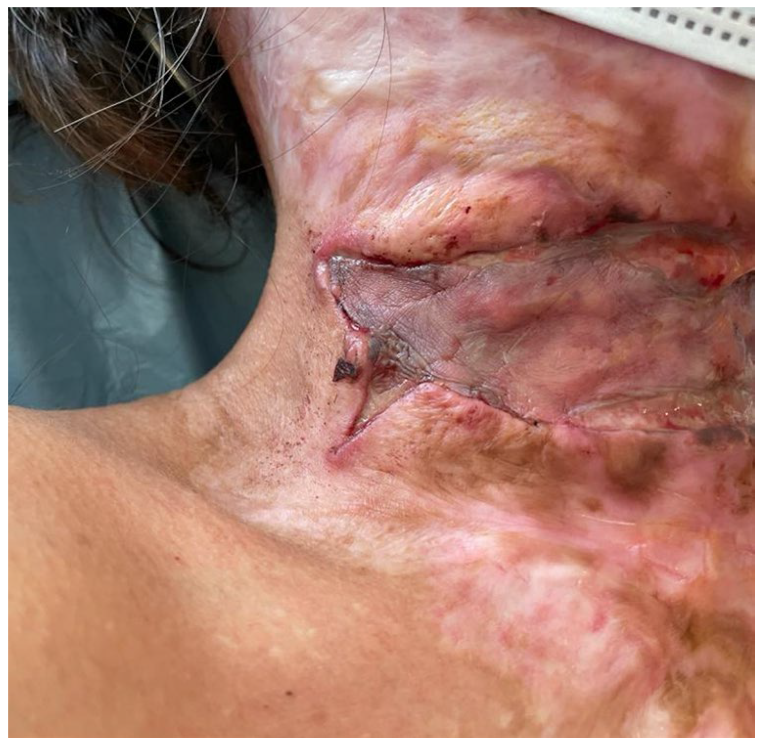 Medicina 61 00744 g007