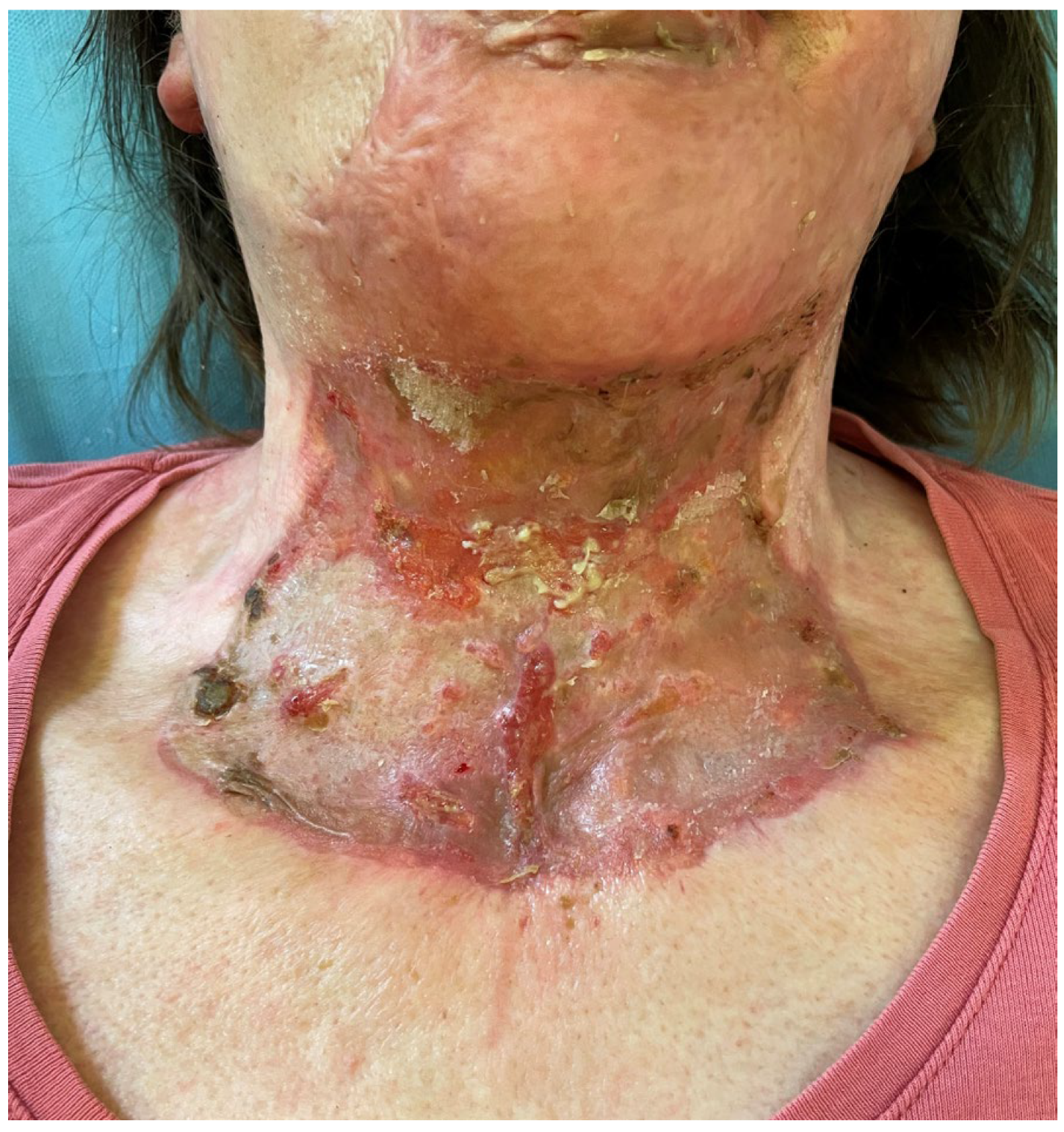 Medicina 61 00744 g011