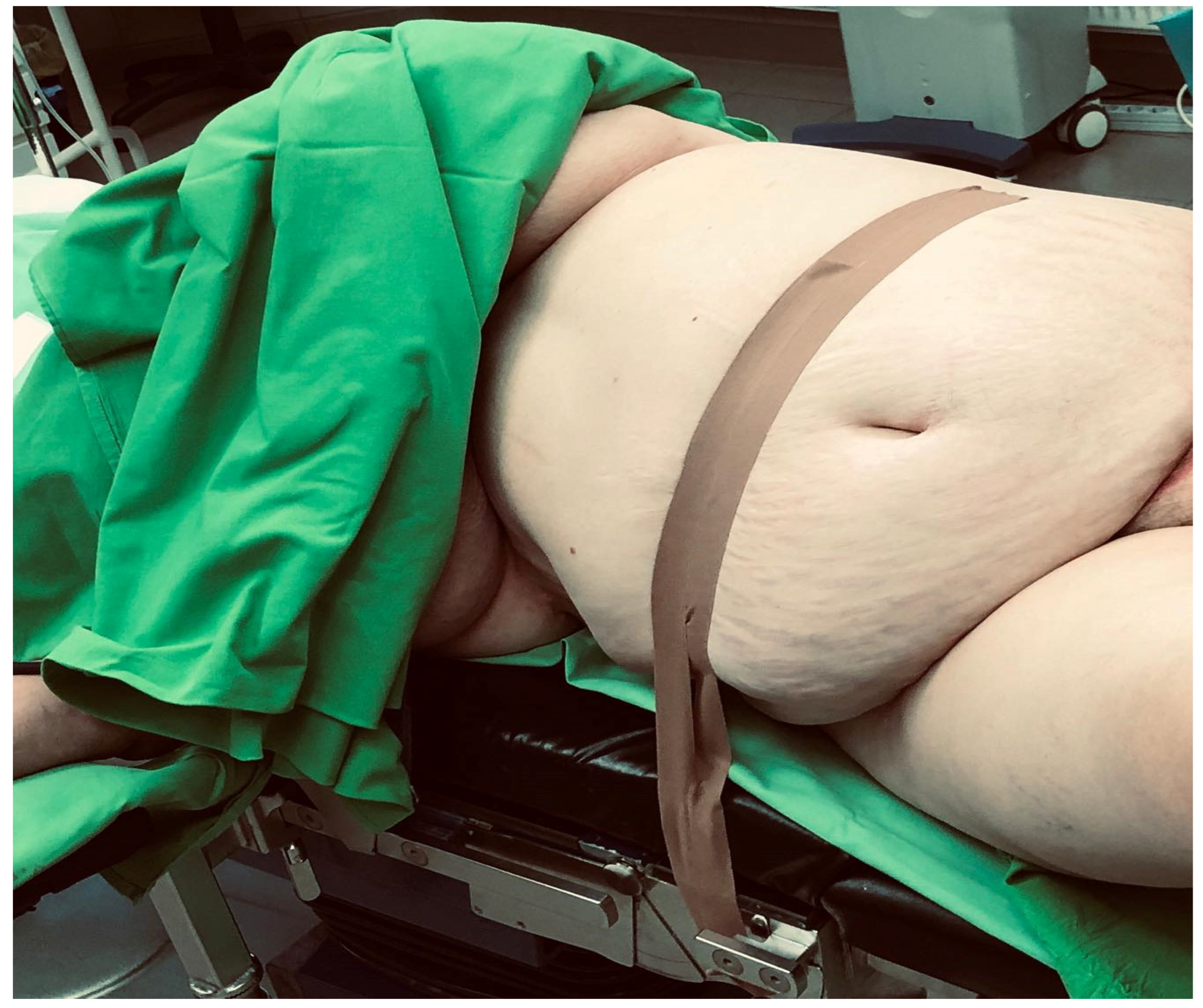 Medicina 61 00748 g002