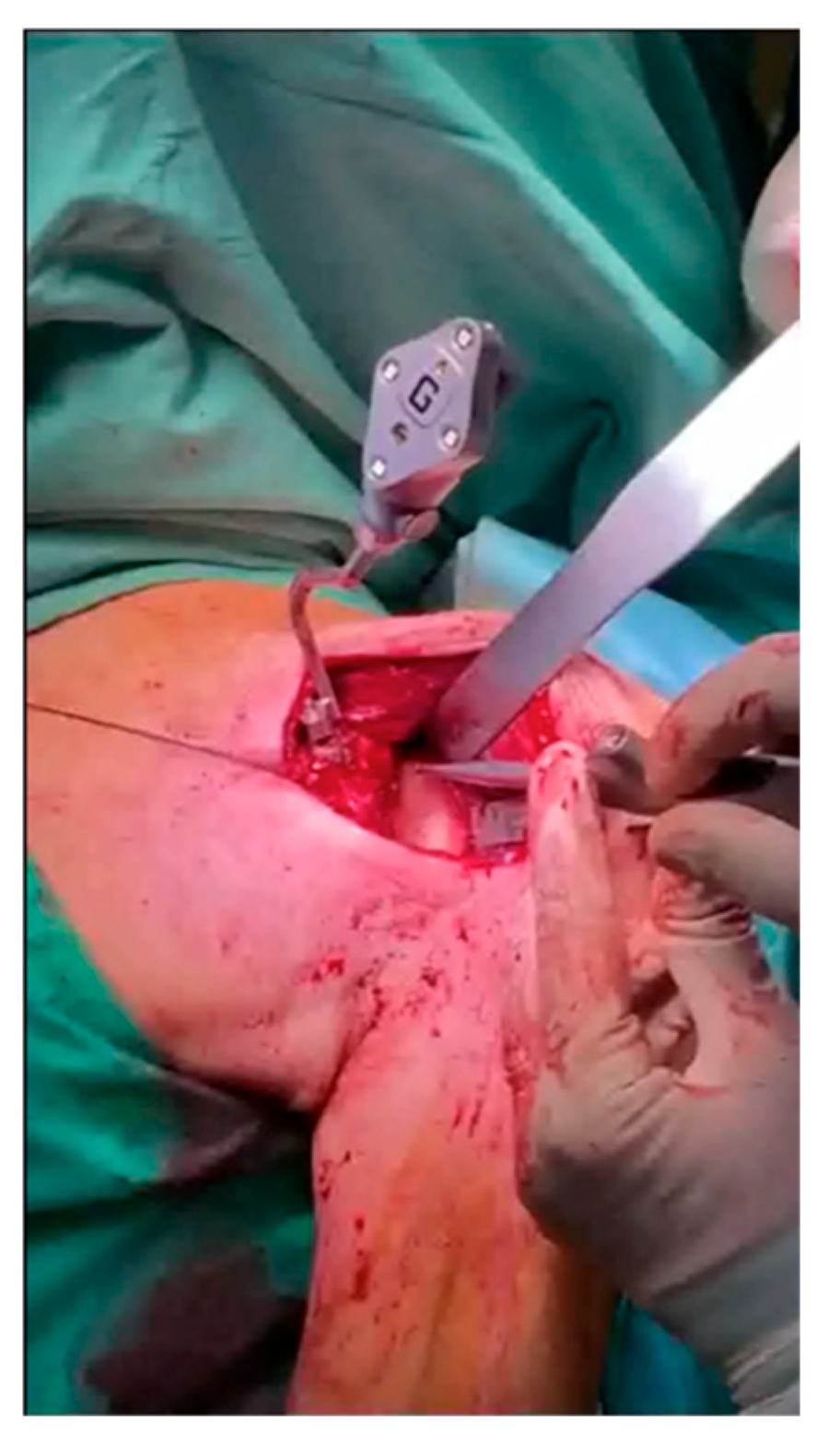 Medicina 61 00749 g002