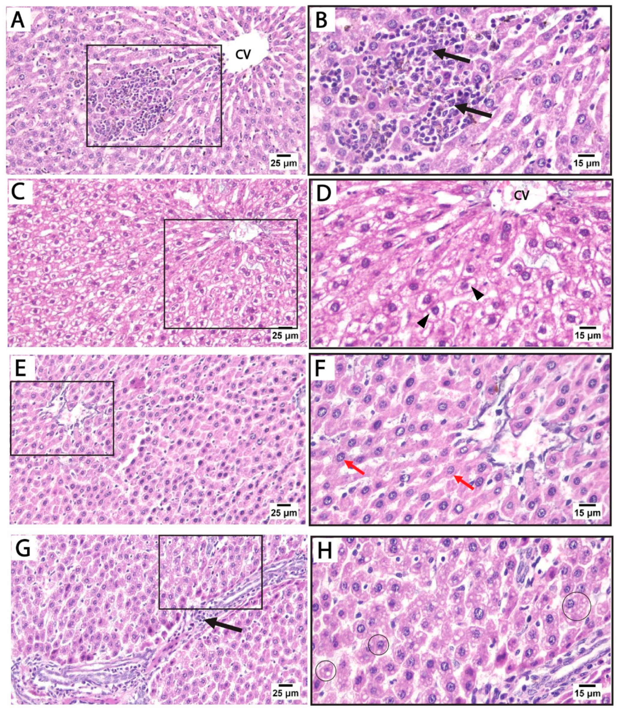 Medicina 61 00751 g004
