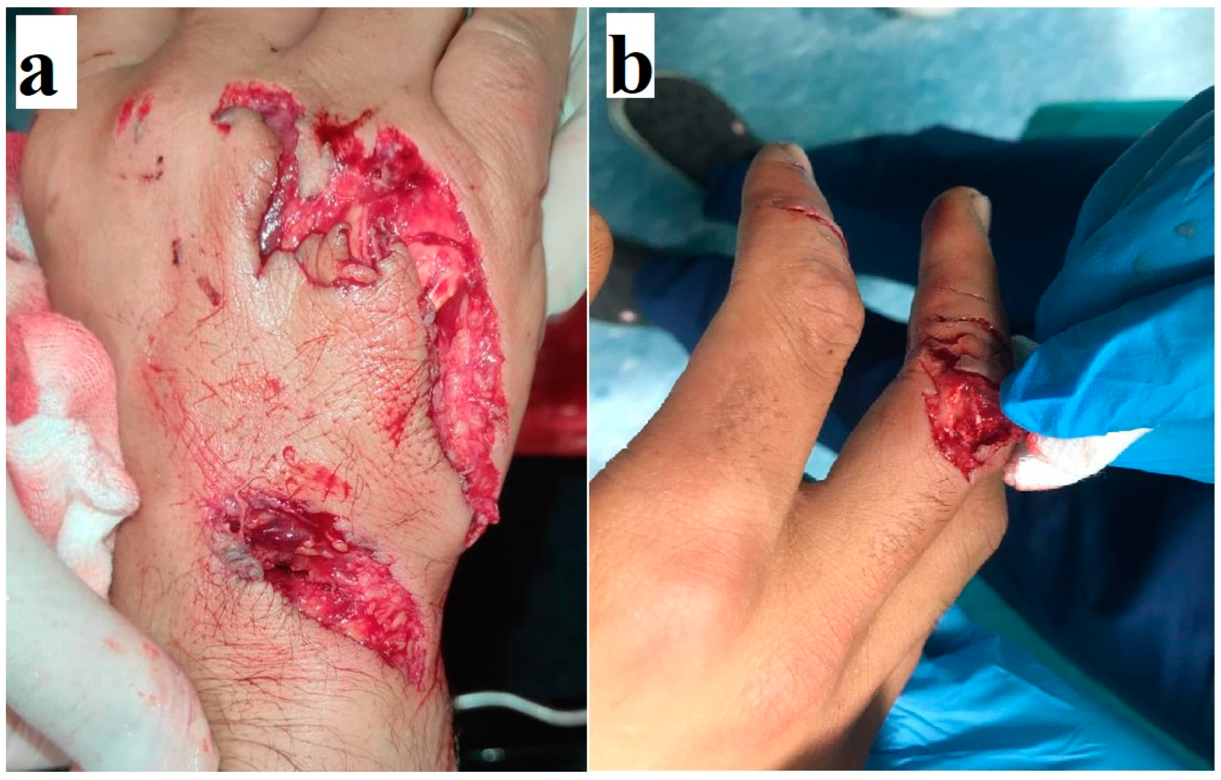 Medicina 61 00759 g002