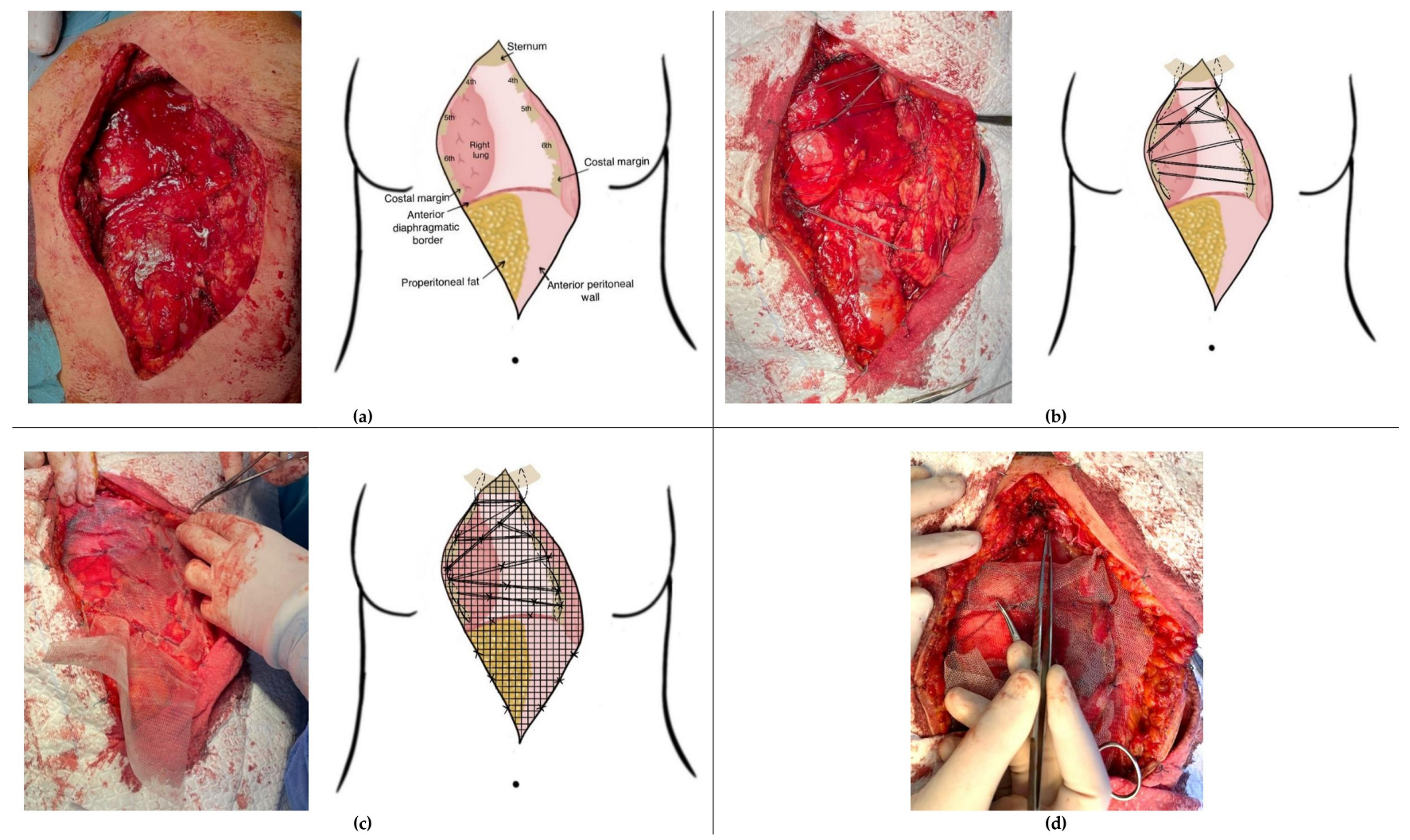 Medicina 61 00763 g001