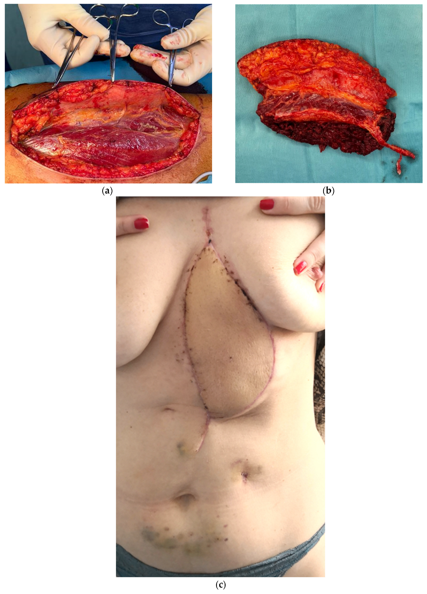 Medicina 61 00763 g002