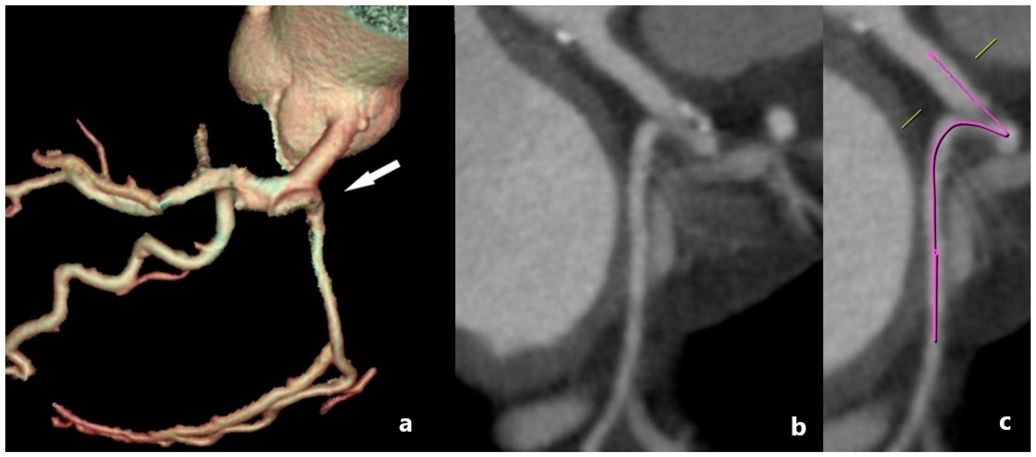 Medicina 61 00765 g003