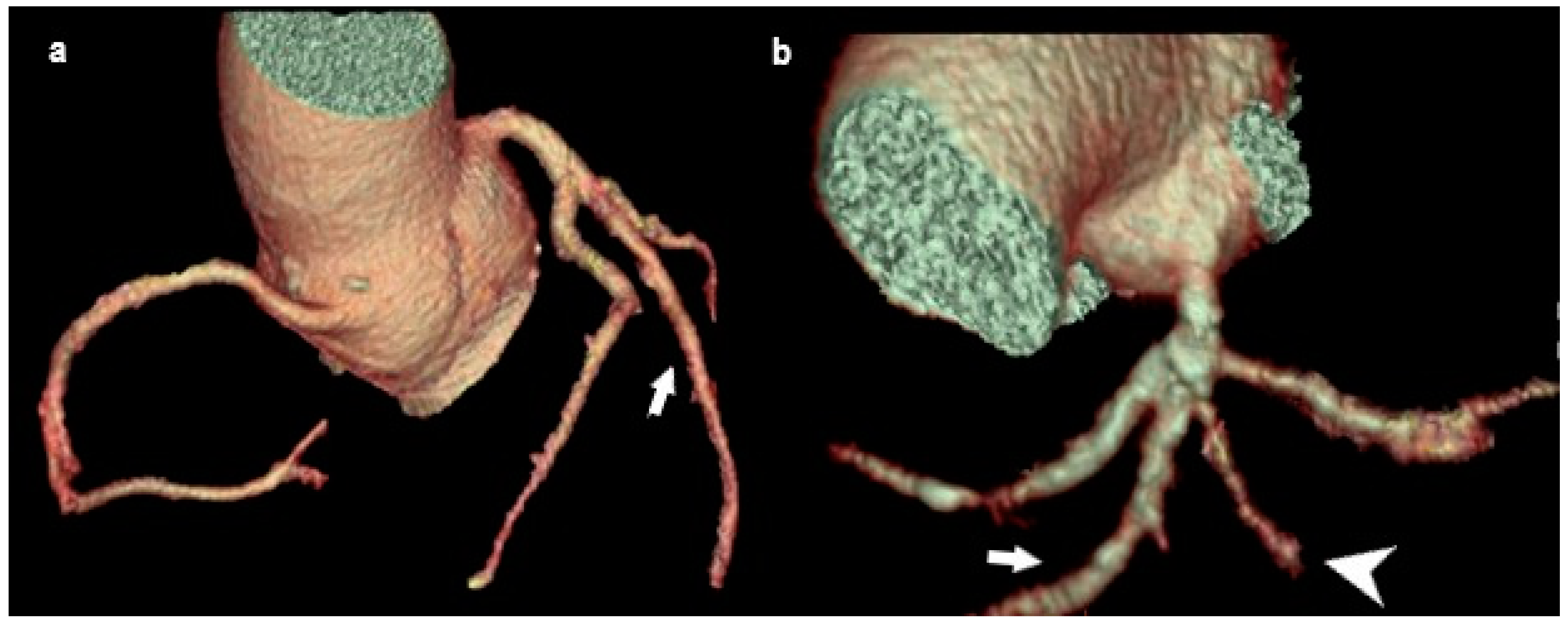 Medicina 61 00765 g006
