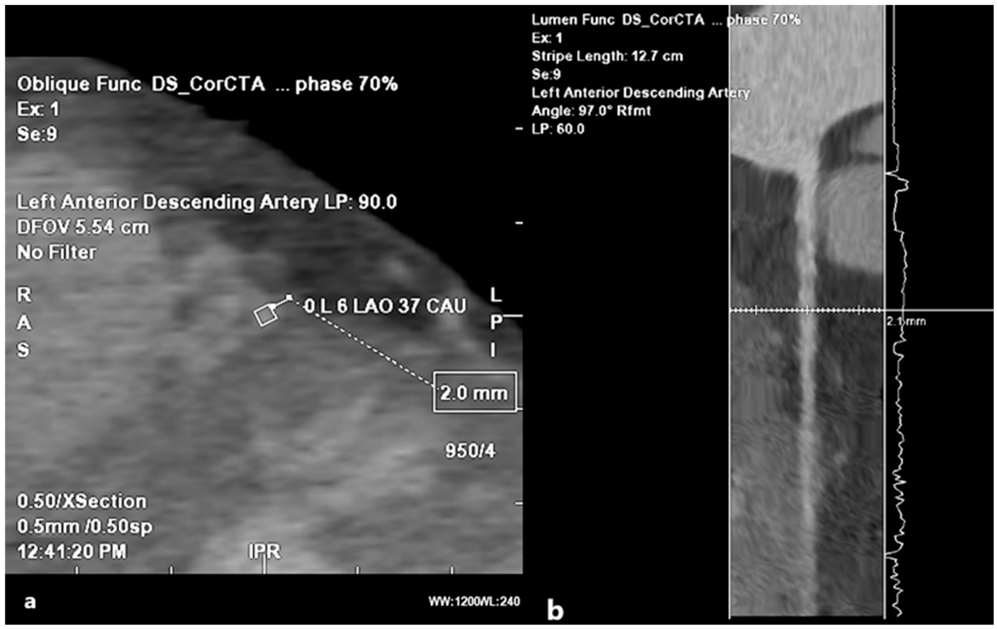 Medicina 61 00765 g010