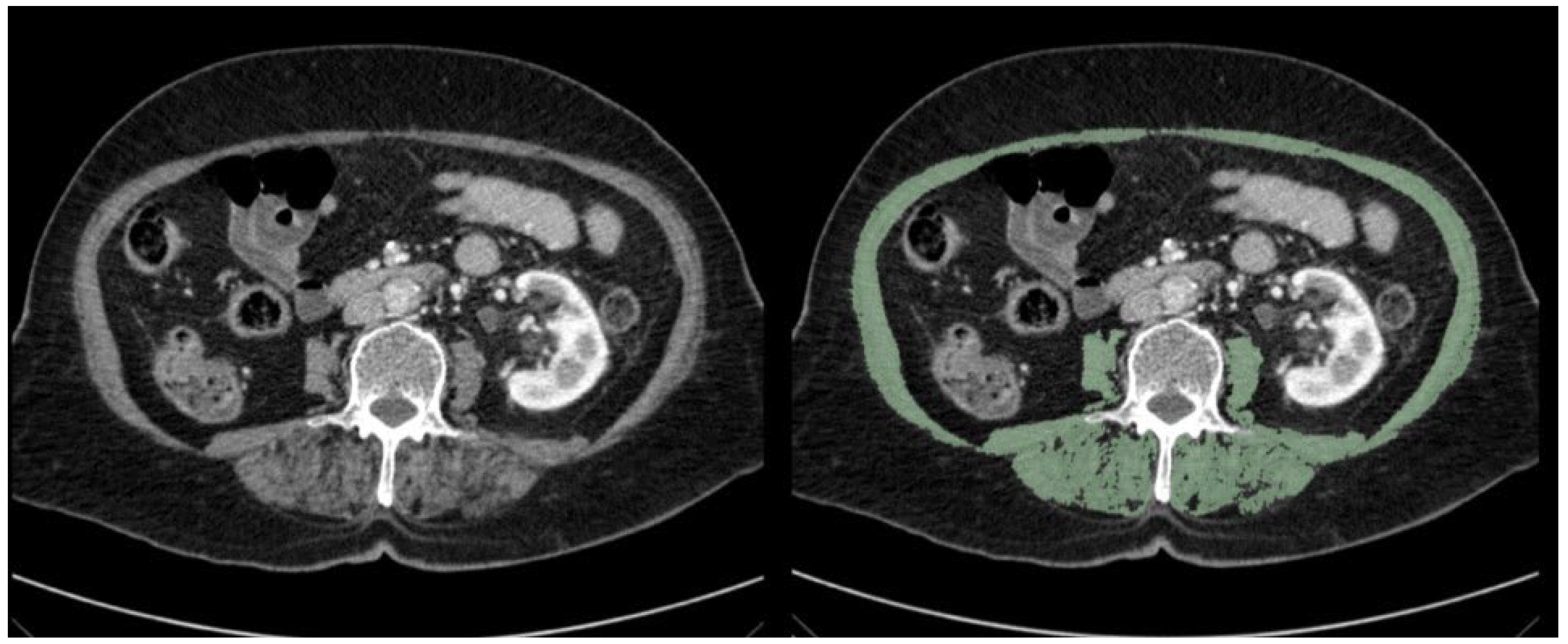 Medicina 61 00785 g001