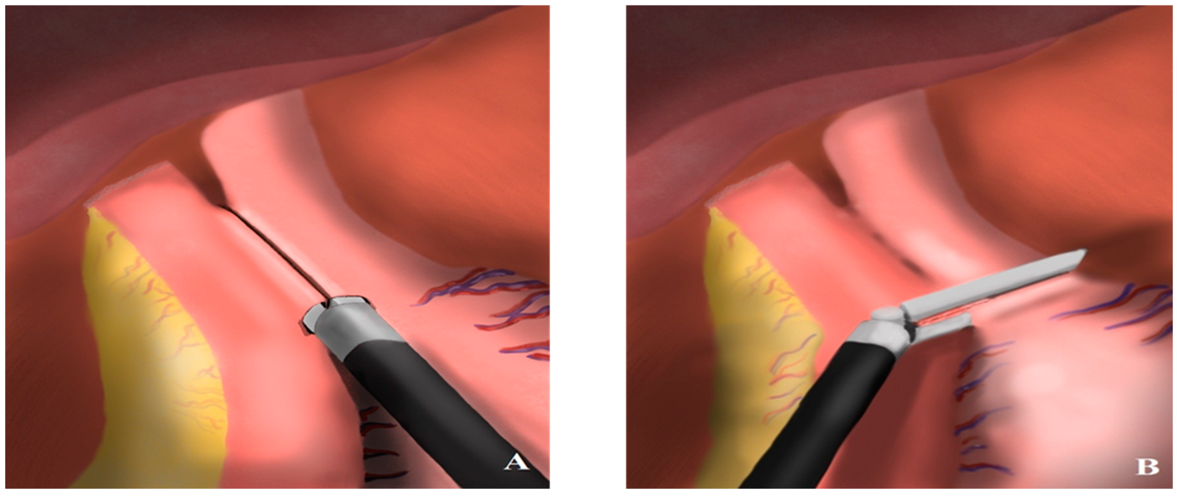 Medicina 61 00795 g002