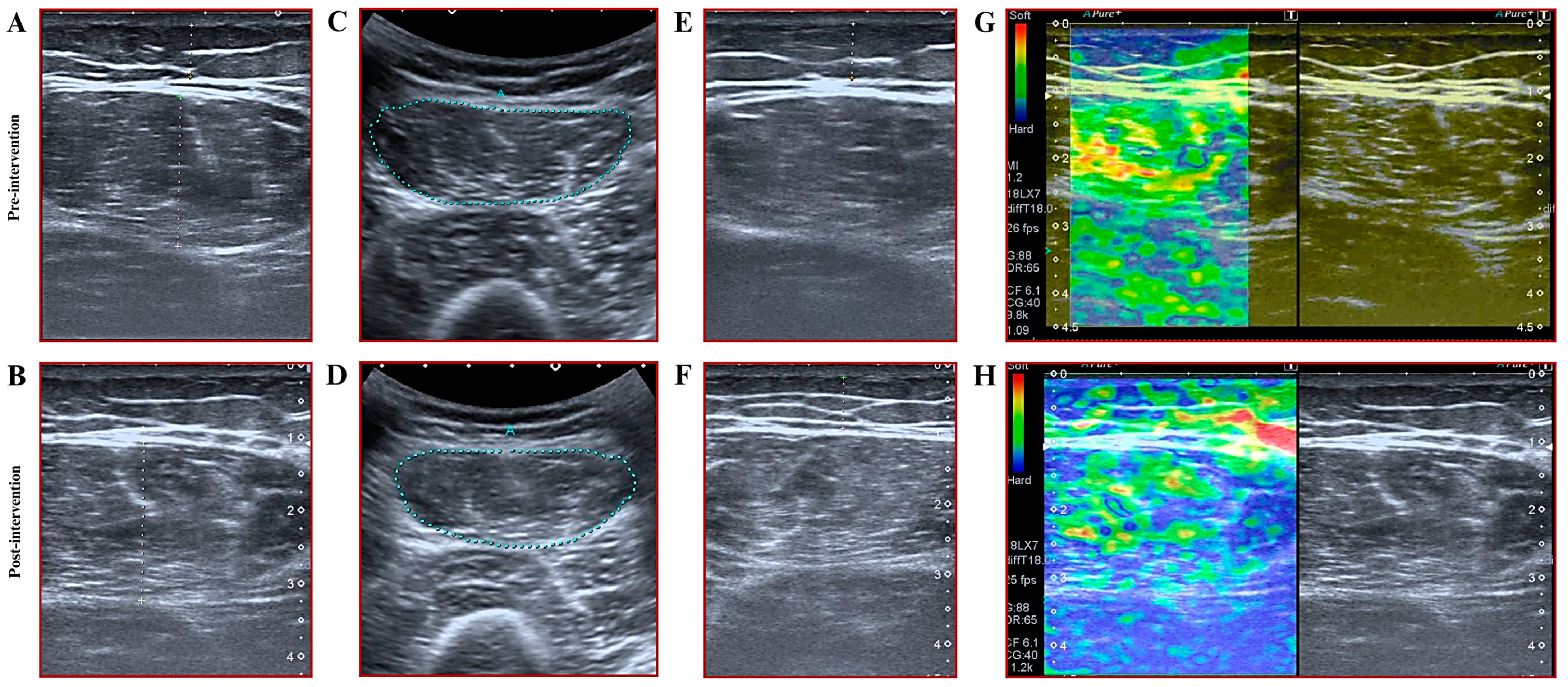 Medicina 61 00804 g003