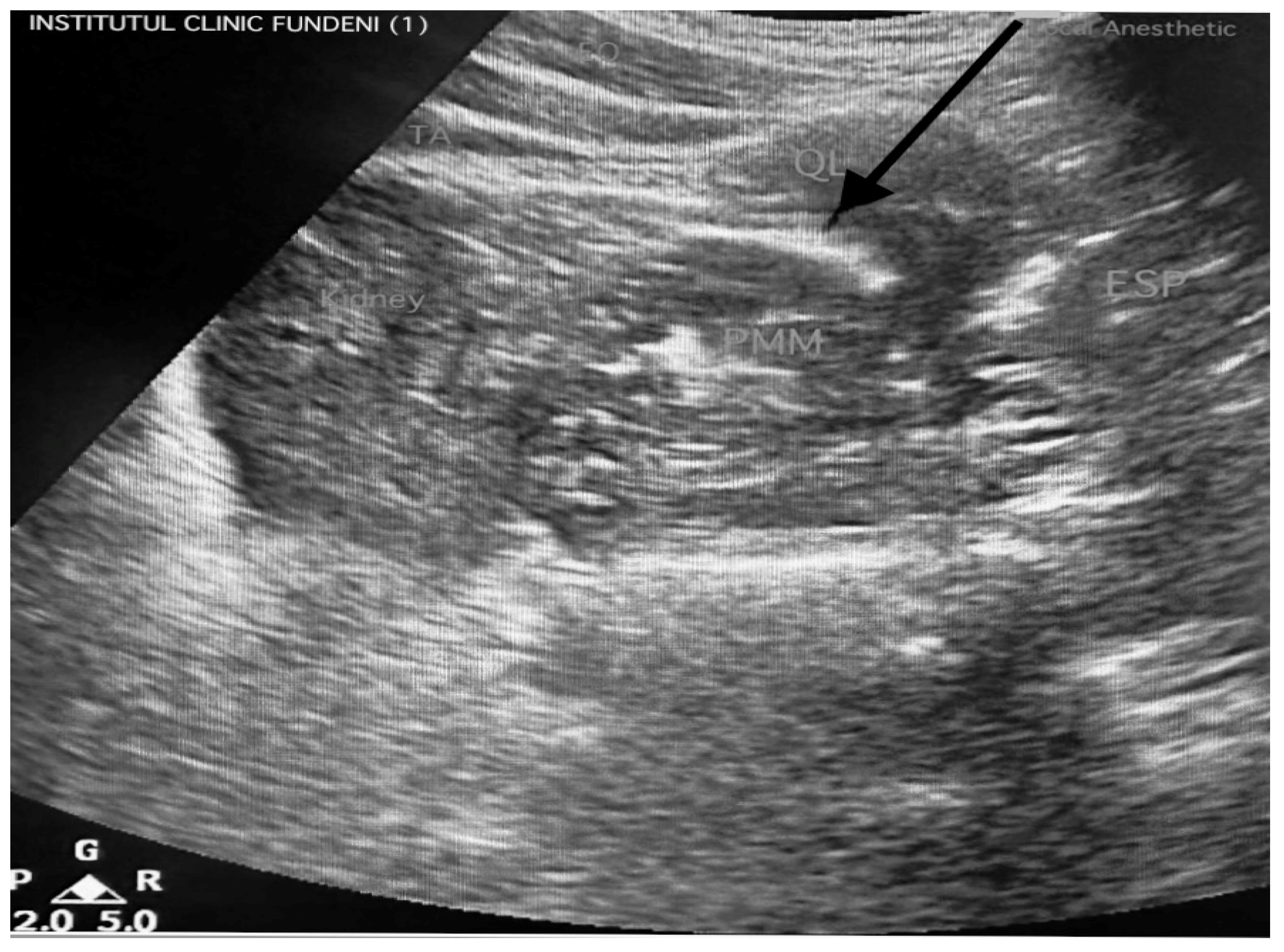 Medicina 61 00825 g001