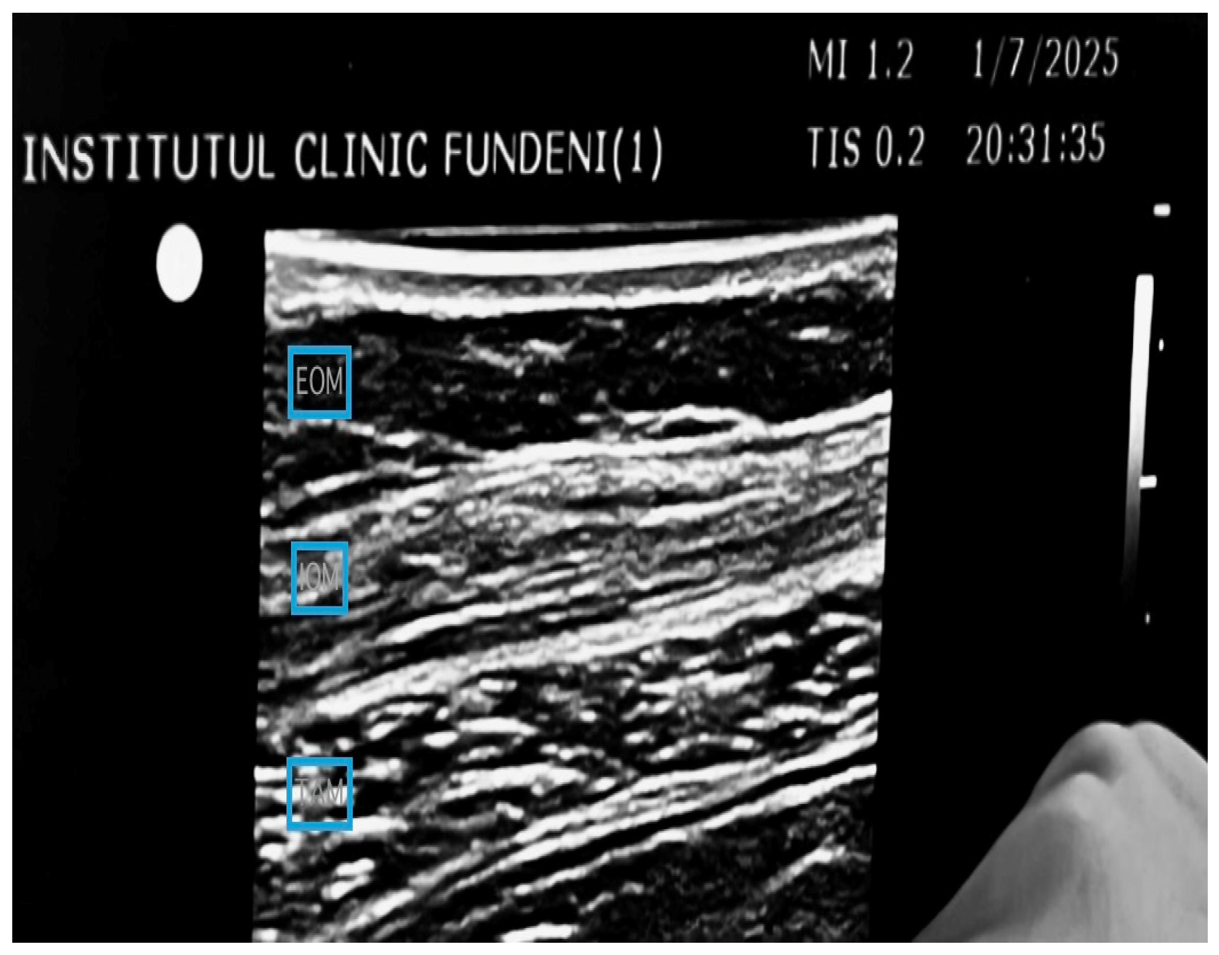 Medicina 61 00825 g002