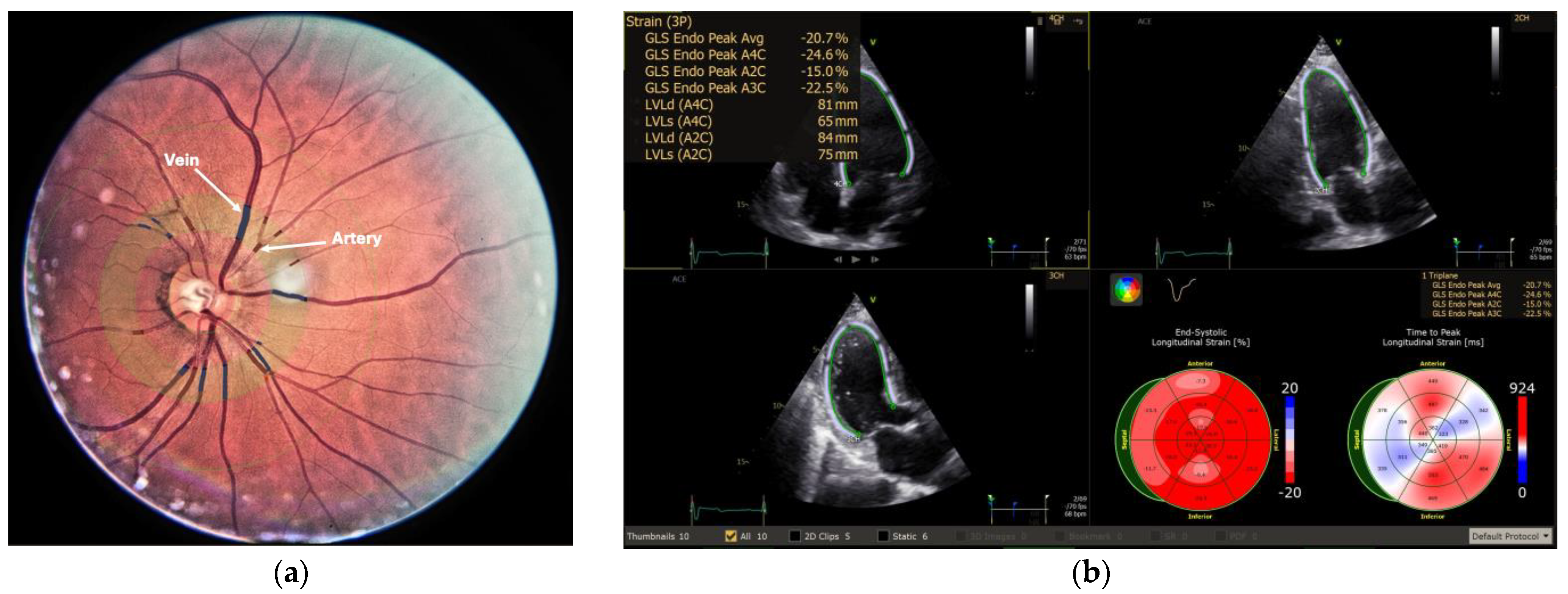 Medicina 61 00834 g001