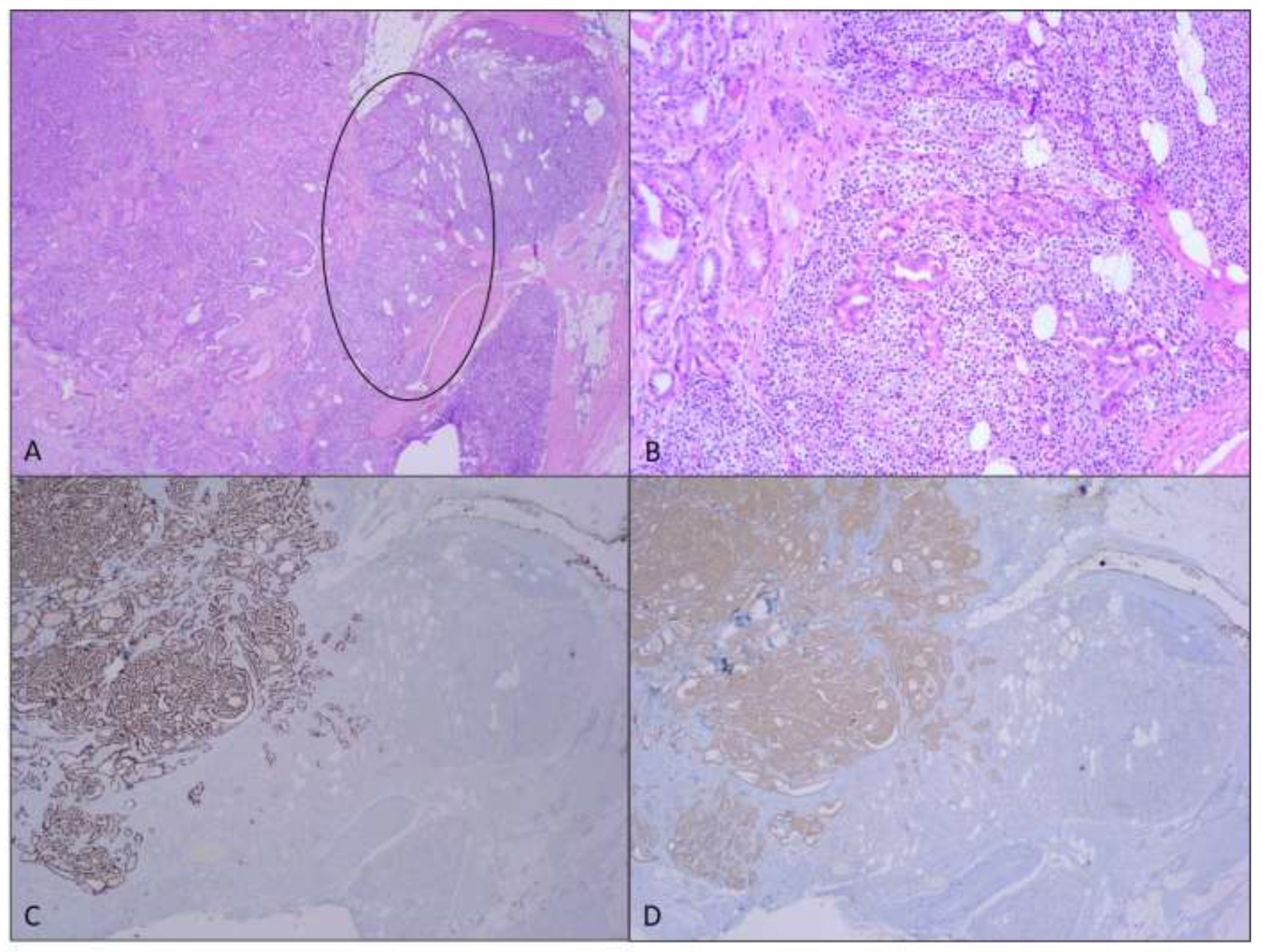 Medicina 61 00836 g001