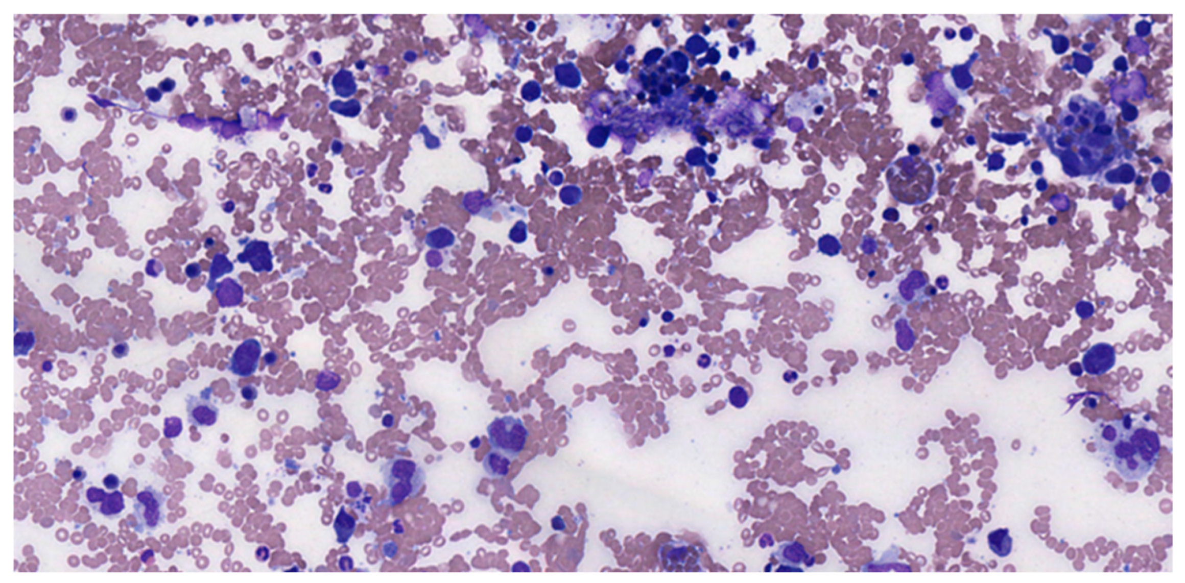 Medicina 61 00842 g001