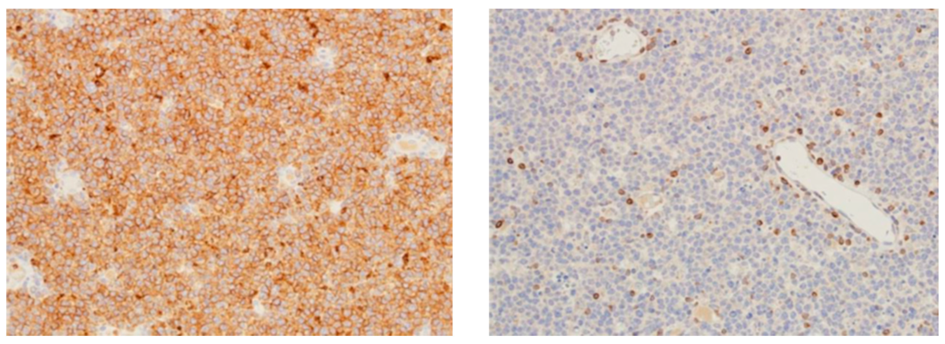 Medicina 61 00842 g005