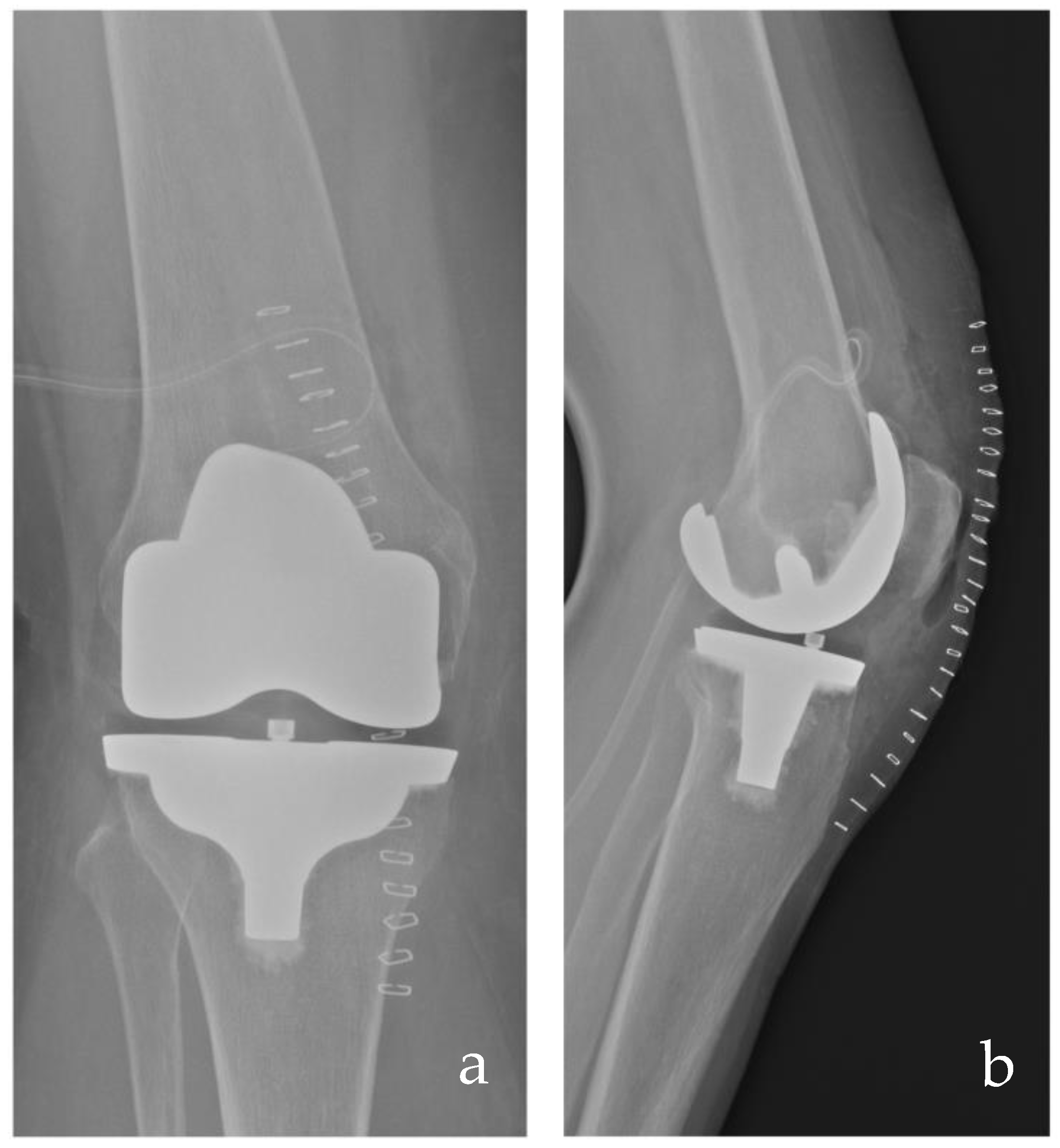 Medicina 61 00844 g003