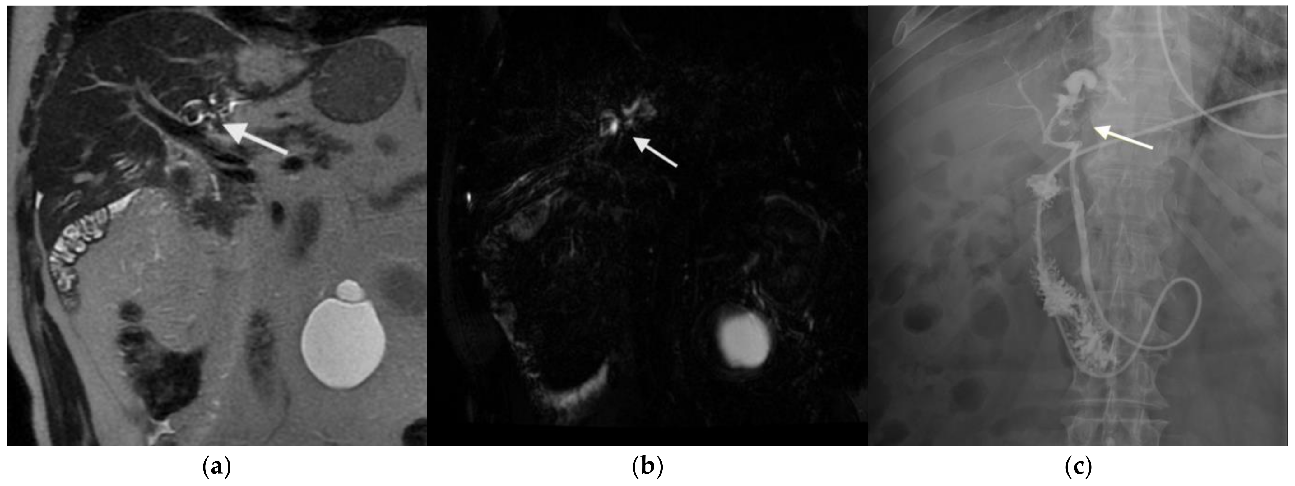 Medicina 61 00860 g001