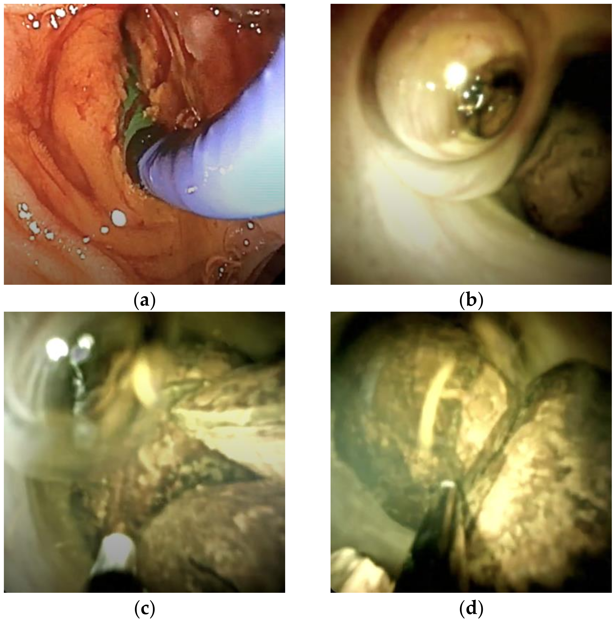 Medicina 61 00860 g002a