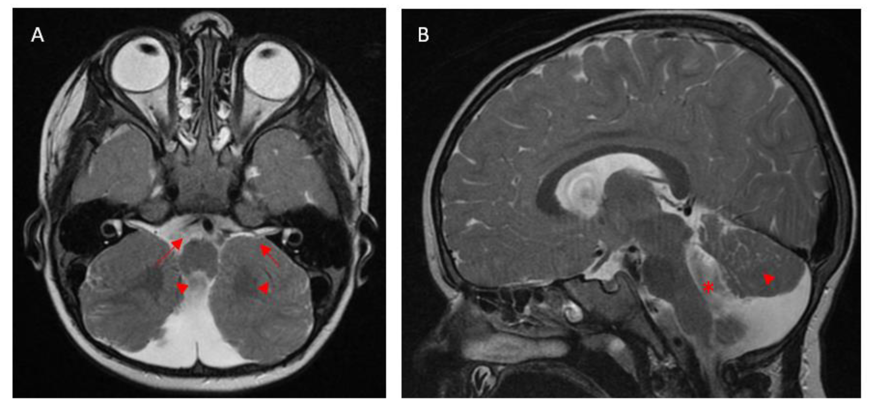 Medicina 61 00881 g001