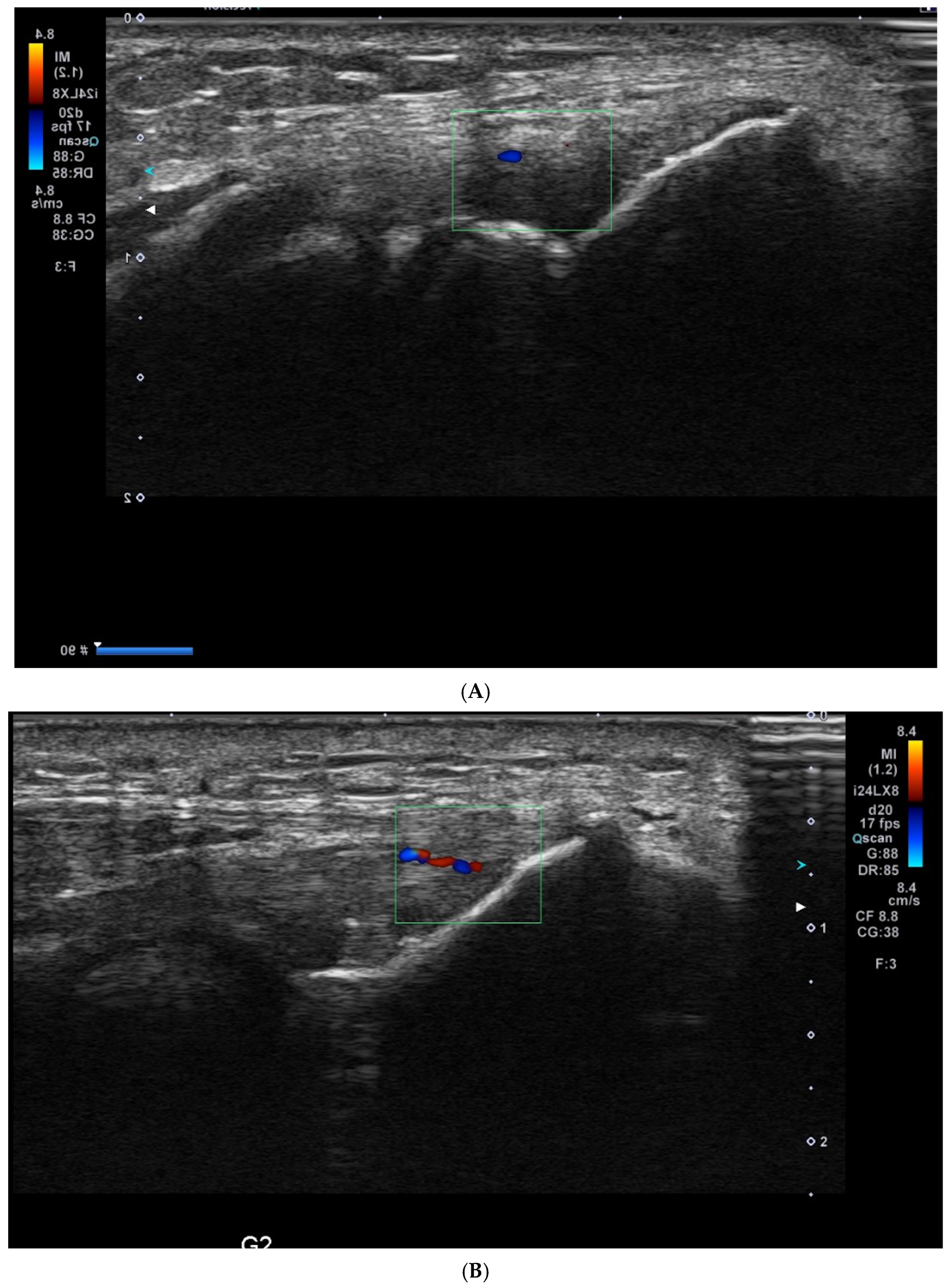 Medicina 61 00894 g002a
