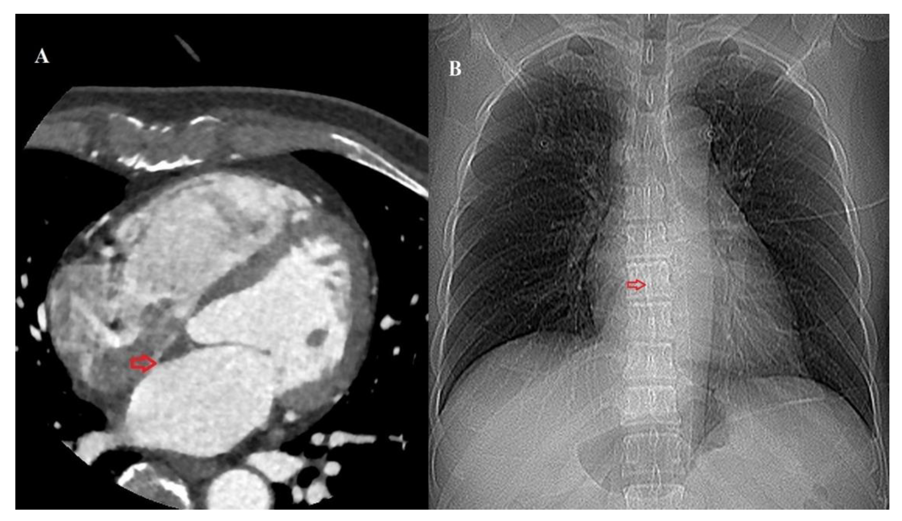 Medicina 61 00896 g001