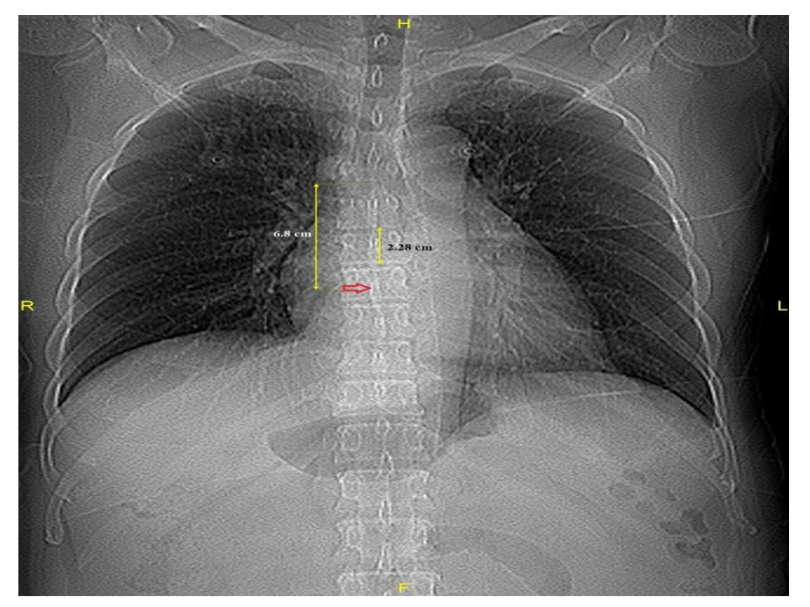Medicina 61 00896 g002