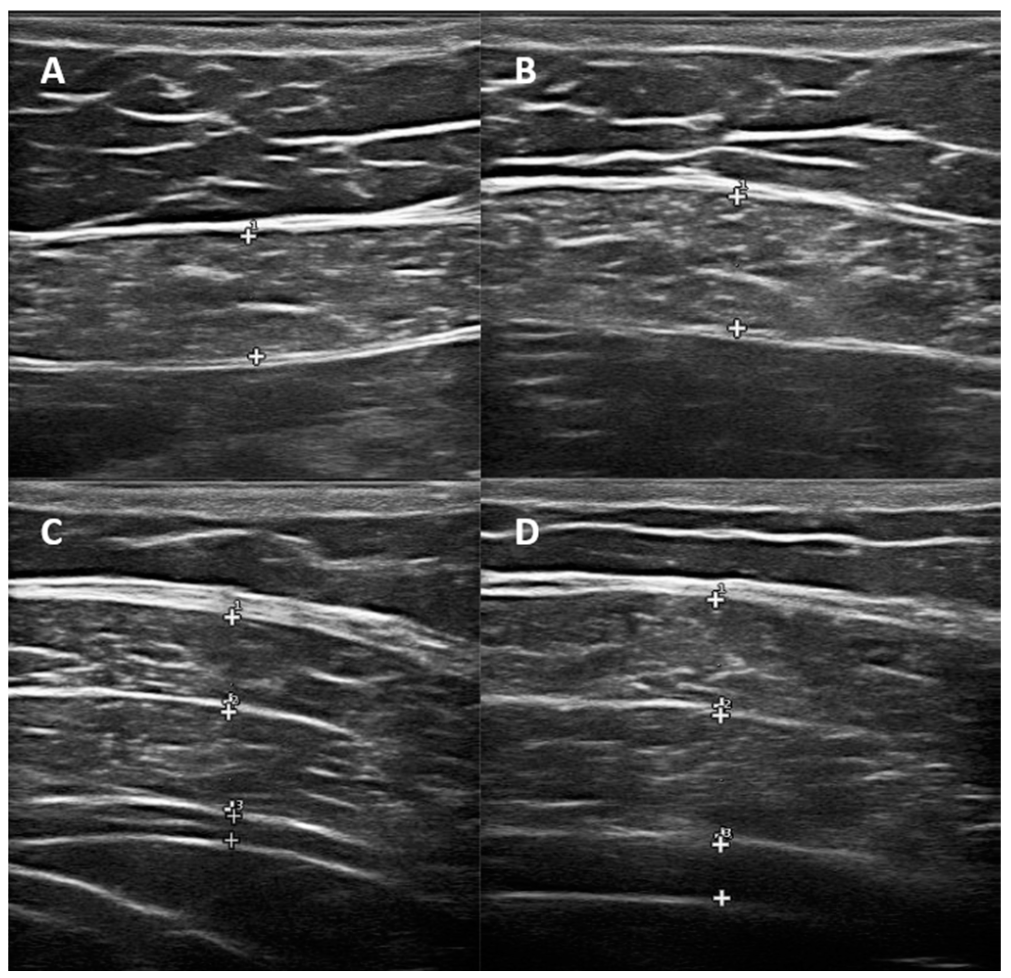 Medicina 61 00897 g001
