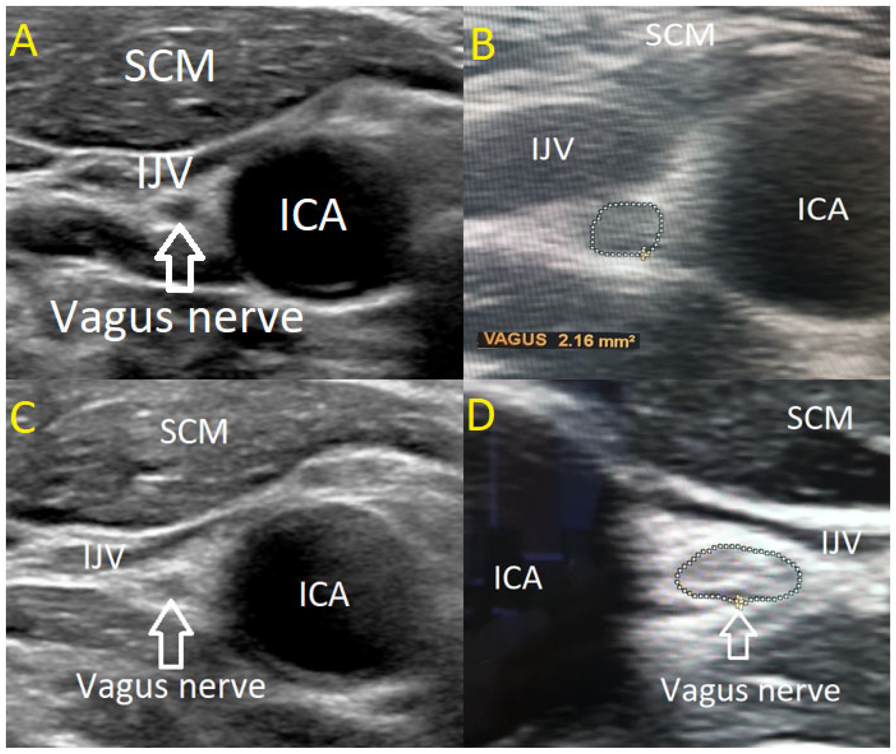 Medicina 61 00902 g001