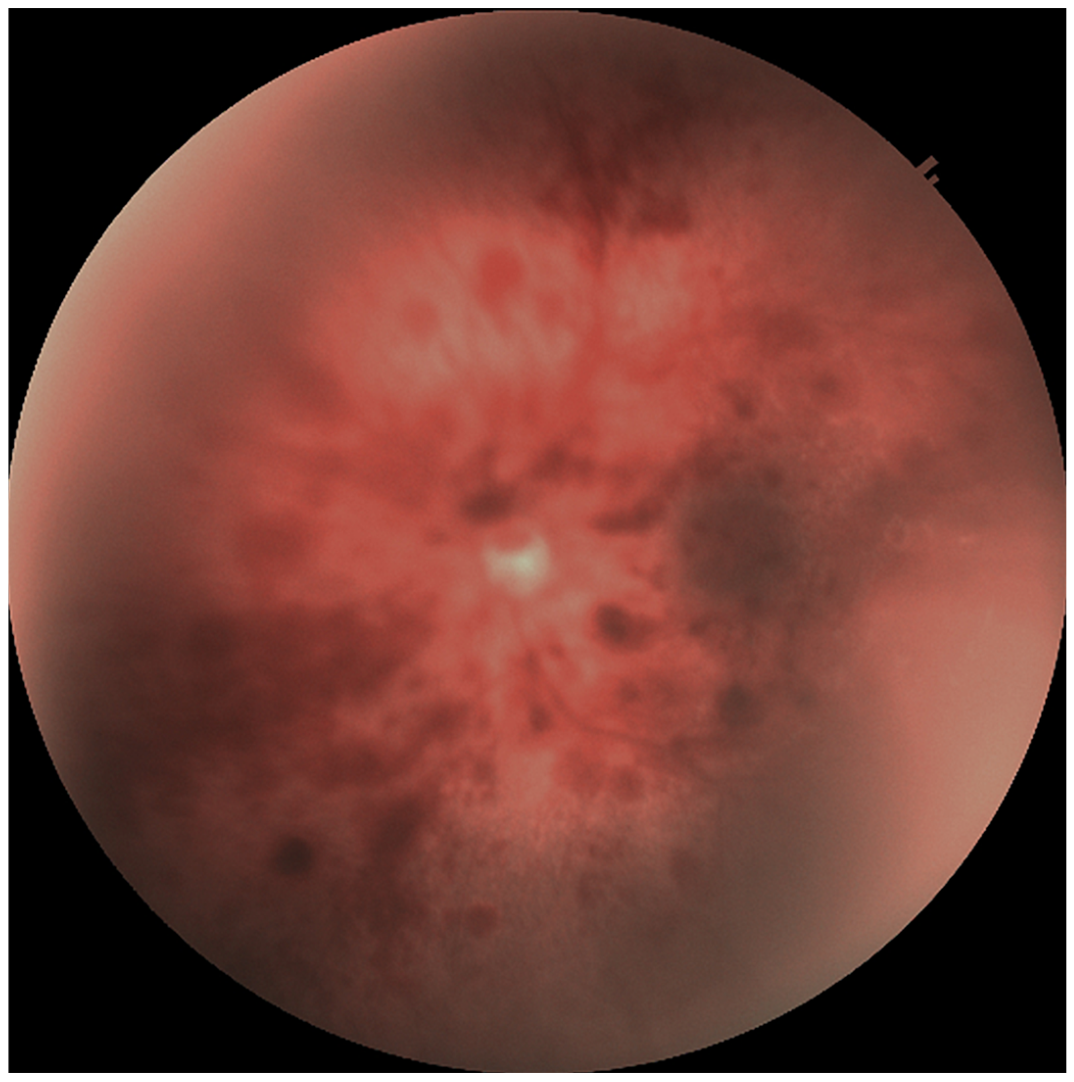 Medicina 61 00906 g002