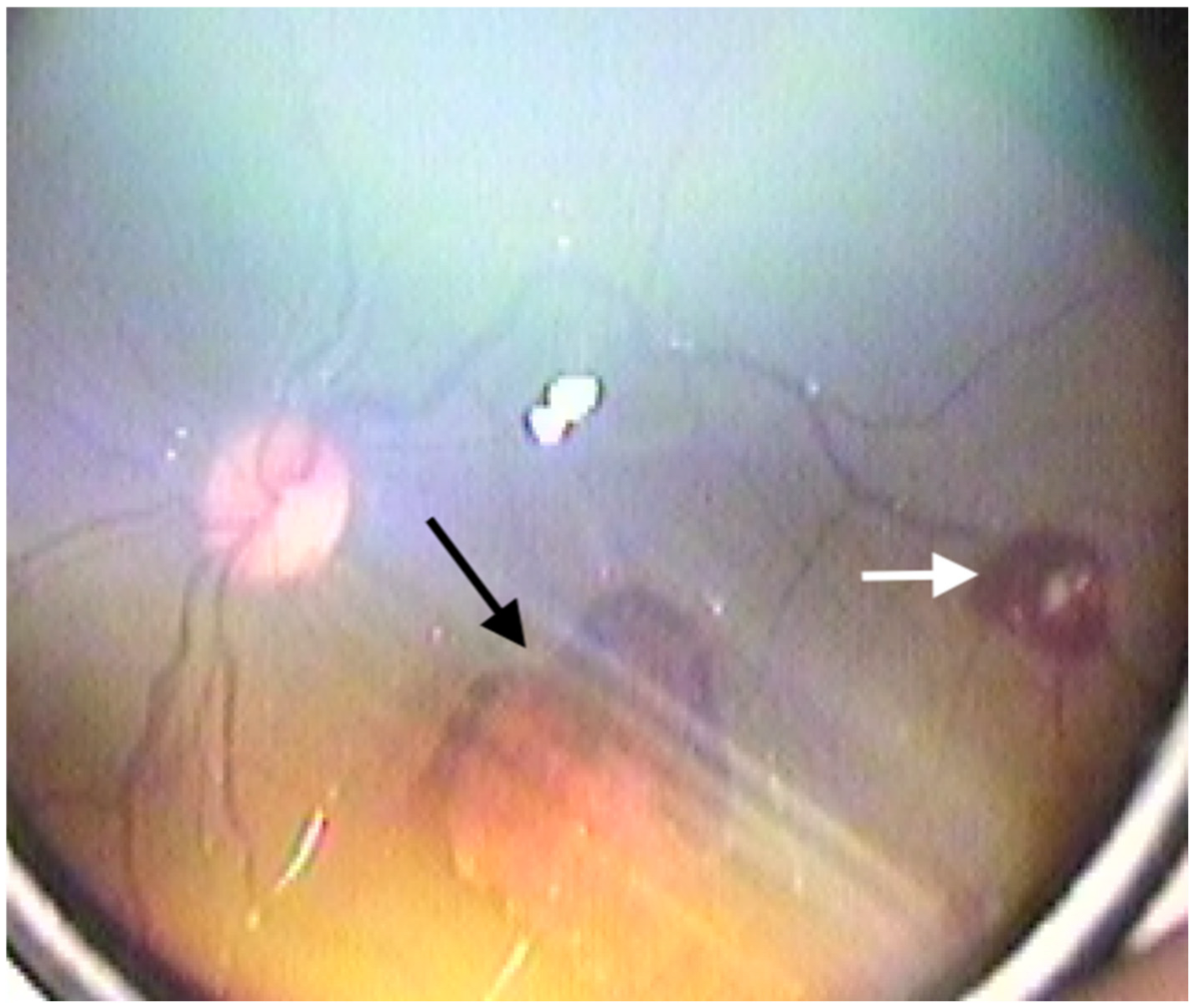 Medicina 61 00906 g003