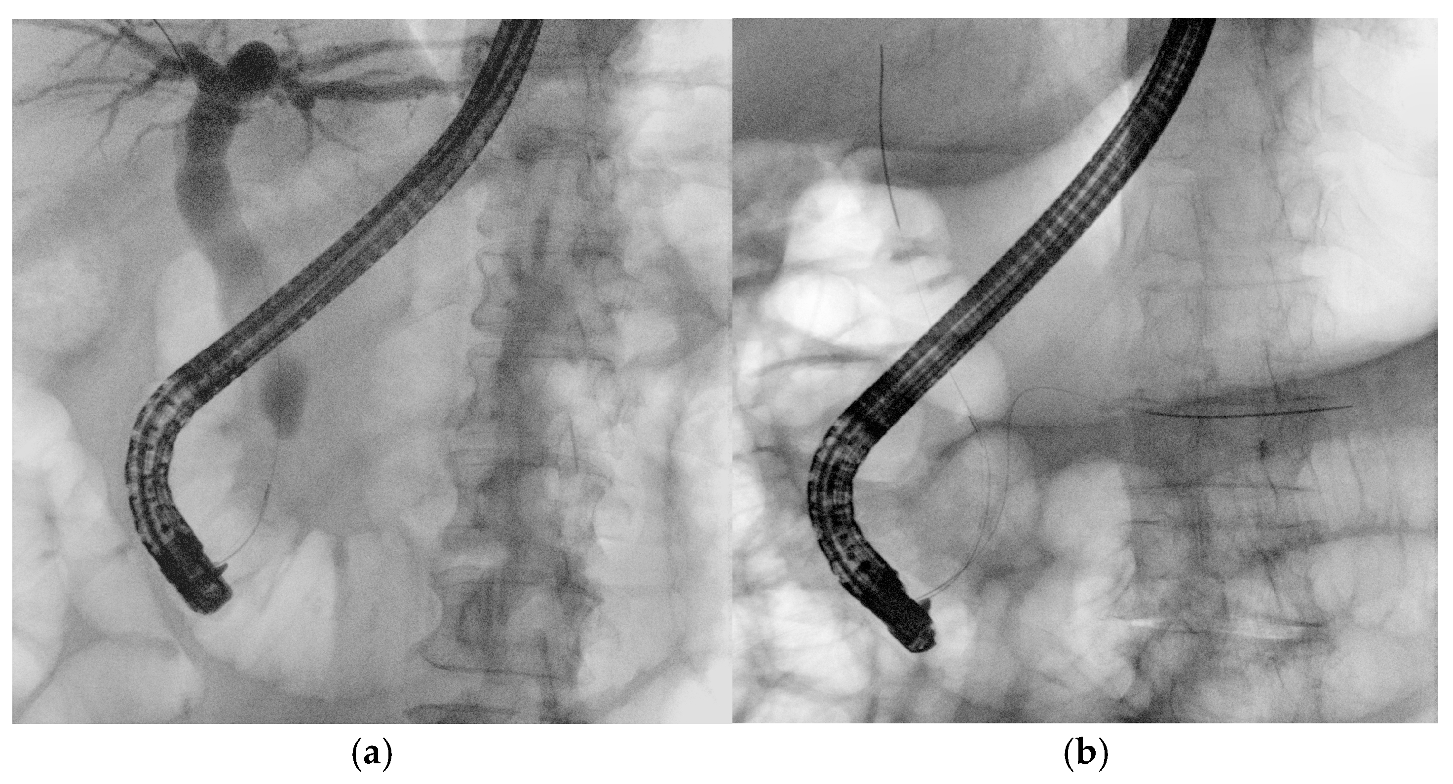 Medicina 61 00913 g004