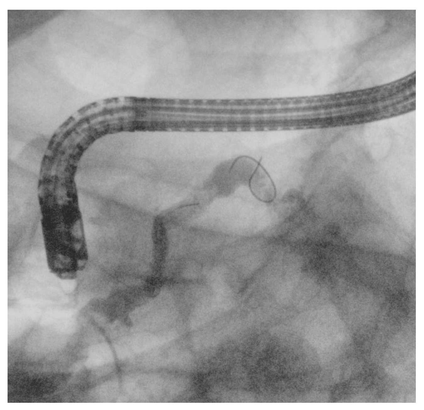 Medicina 61 00913 g005