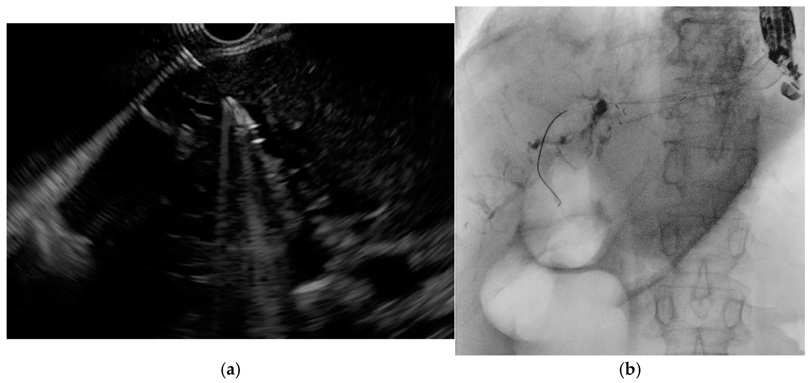 Medicina 61 00913 g007