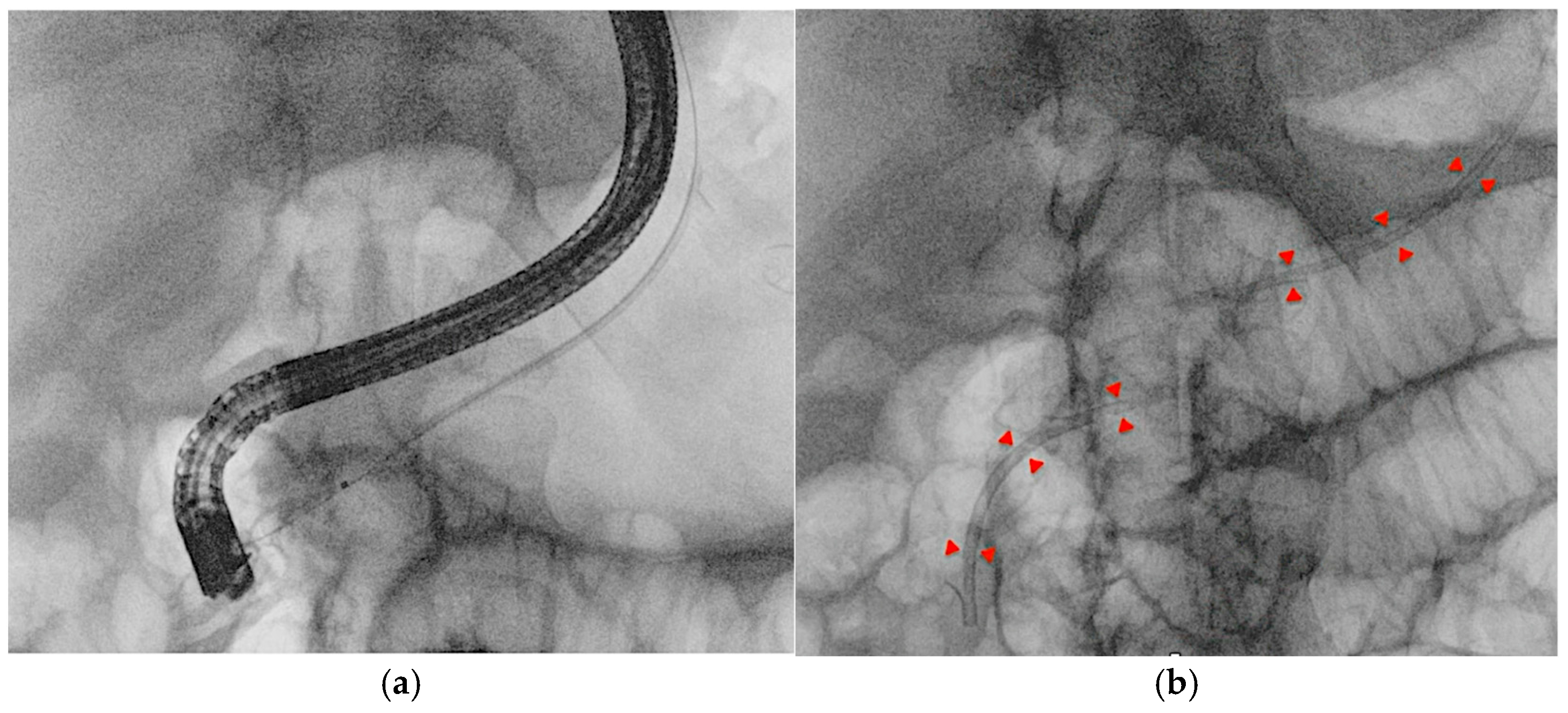 Medicina 61 00913 g008