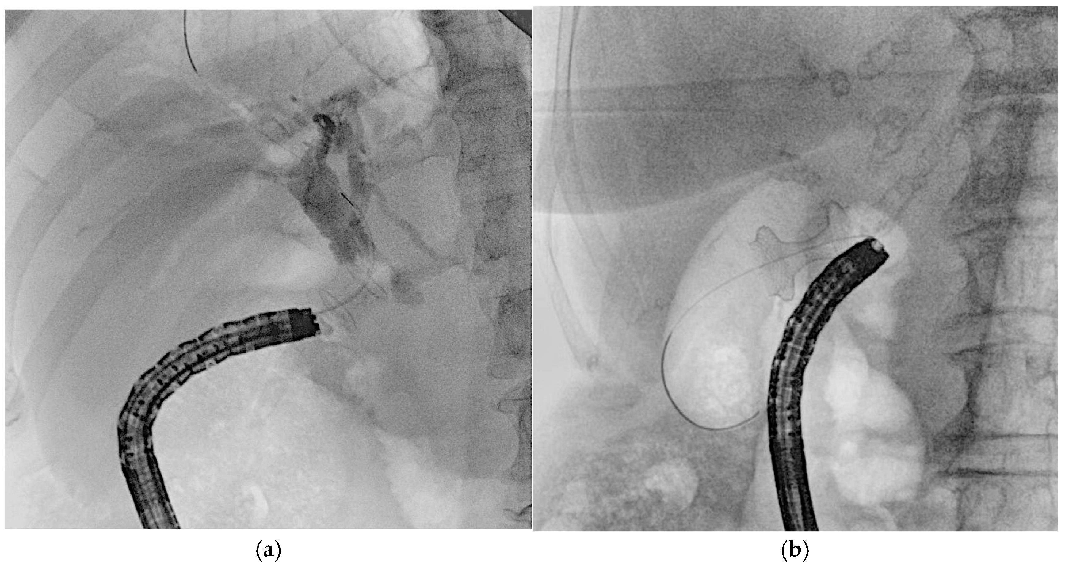 Medicina 61 00913 g009
