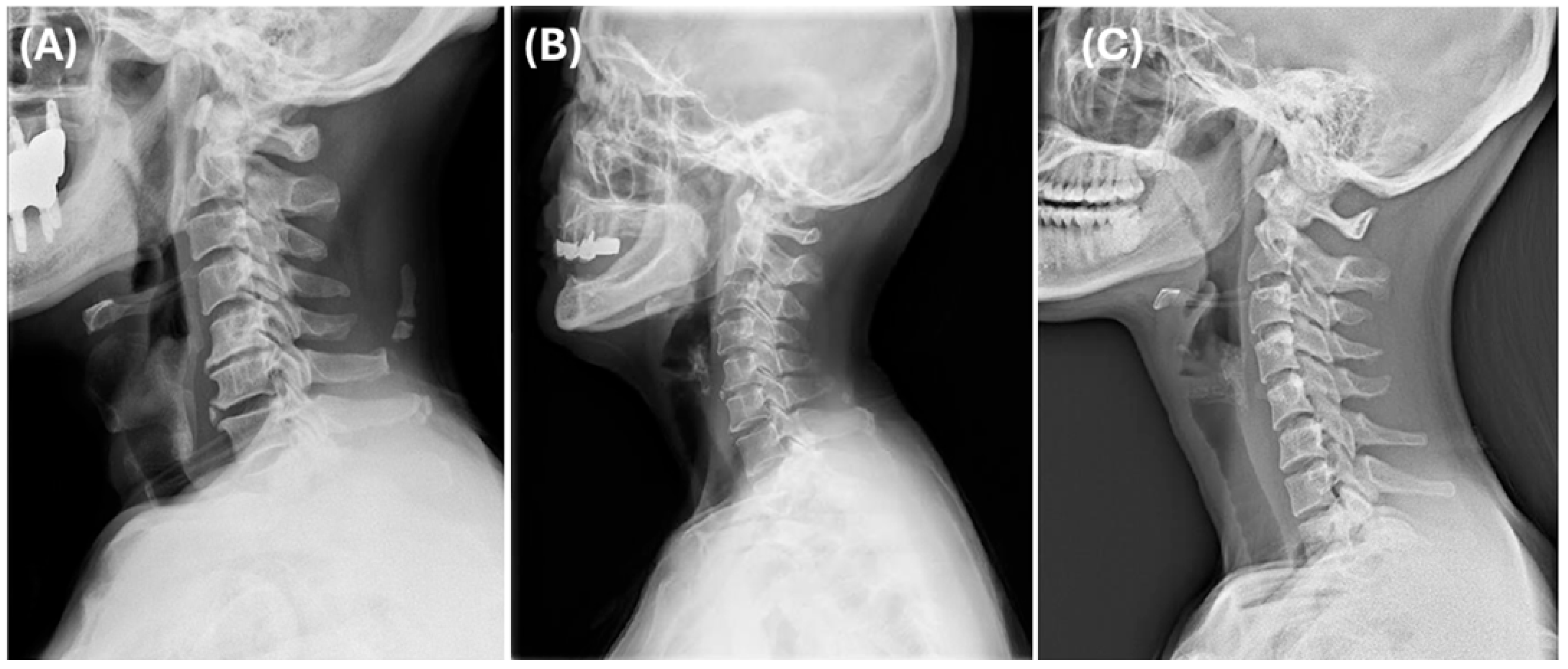 Medicina 61 00916 g004