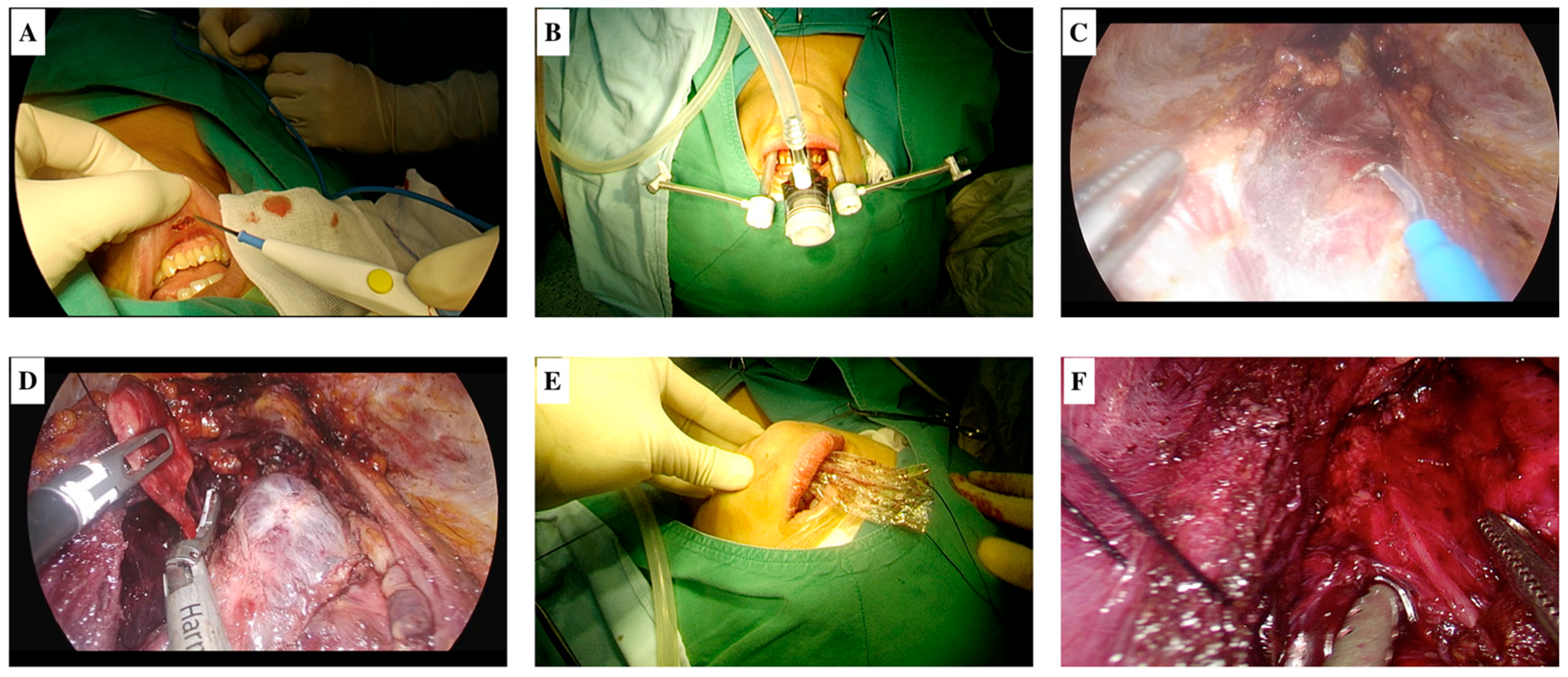 Medicina 61 00939 g002