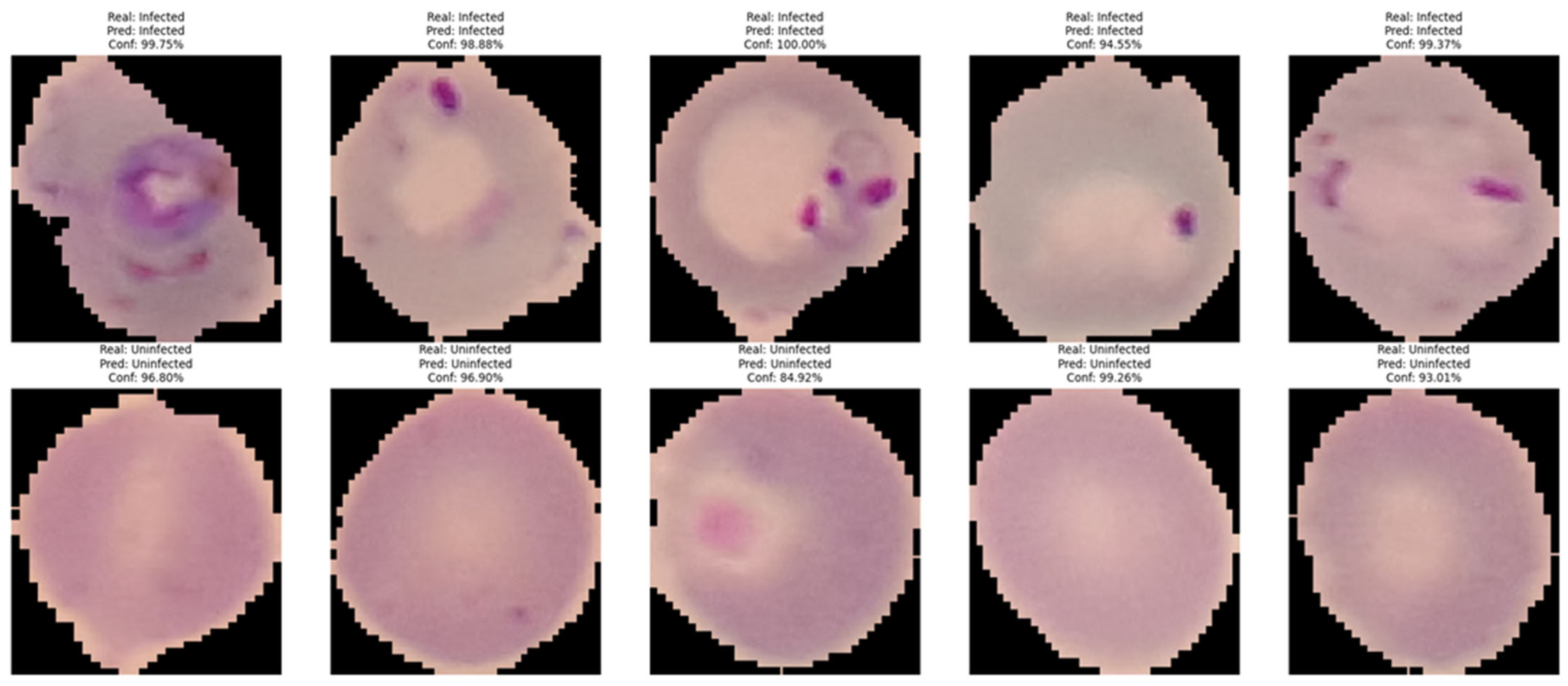 Medicina 61 00940 g004