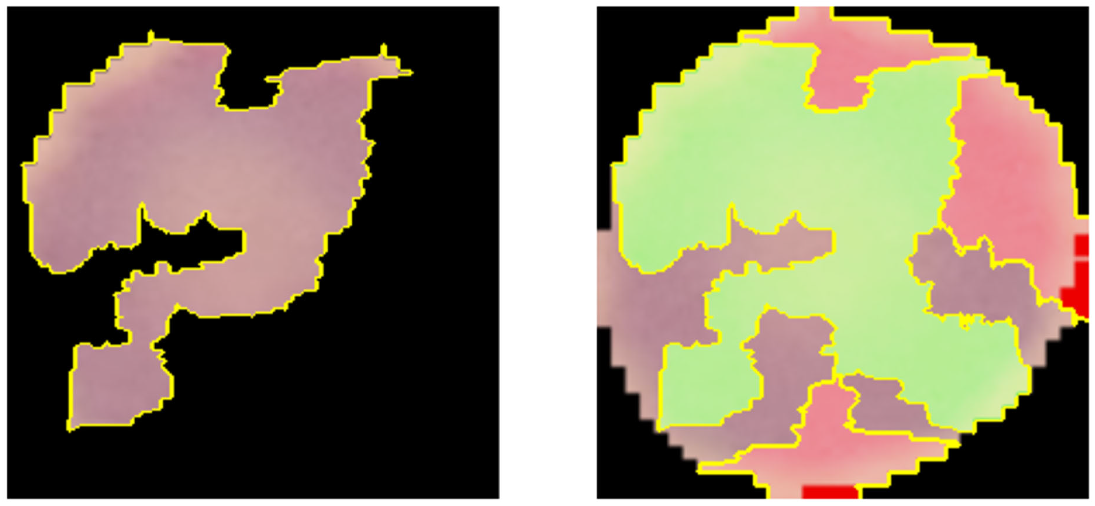 Medicina 61 00940 g005