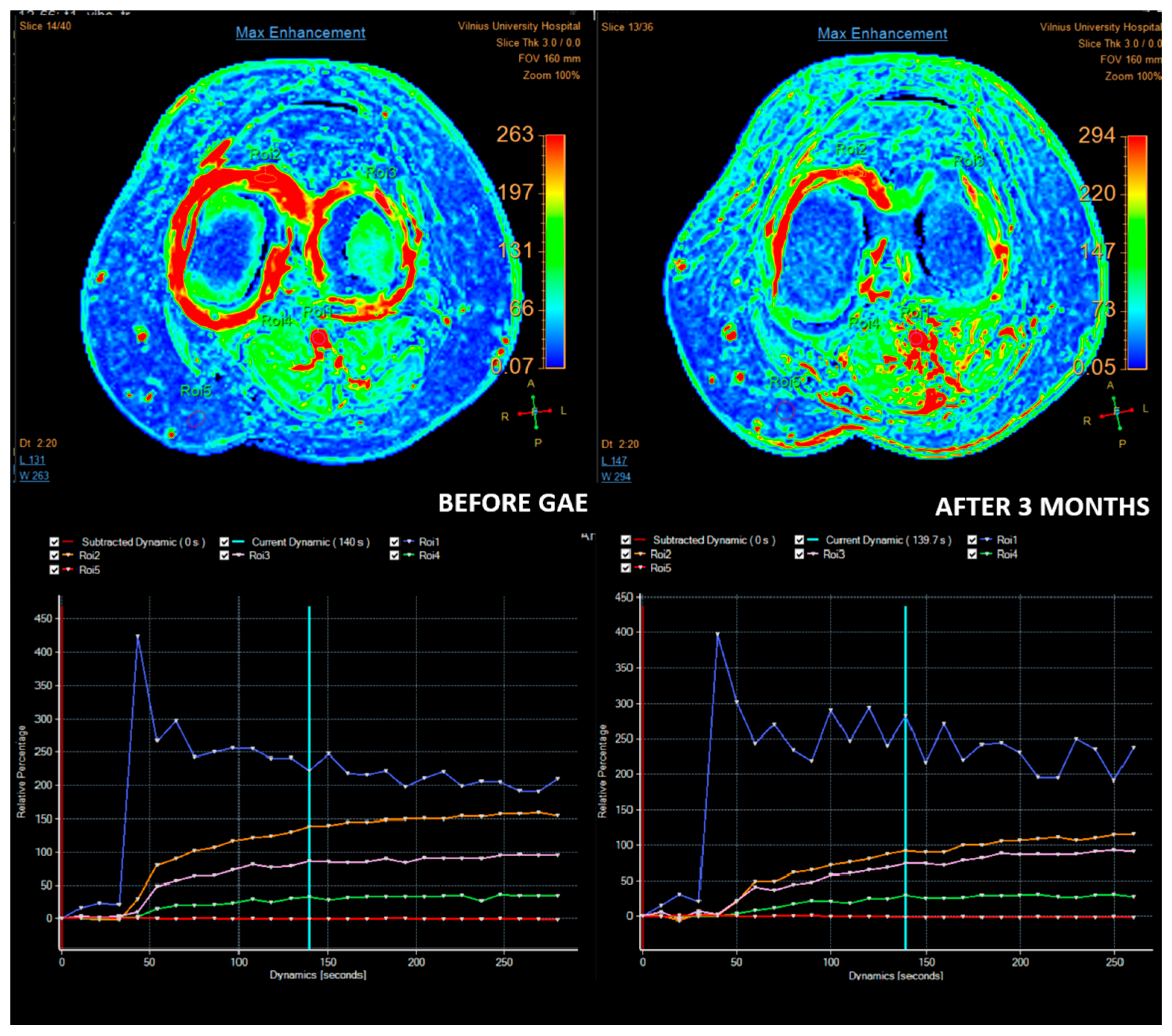 Medicina 61 00941 g001
