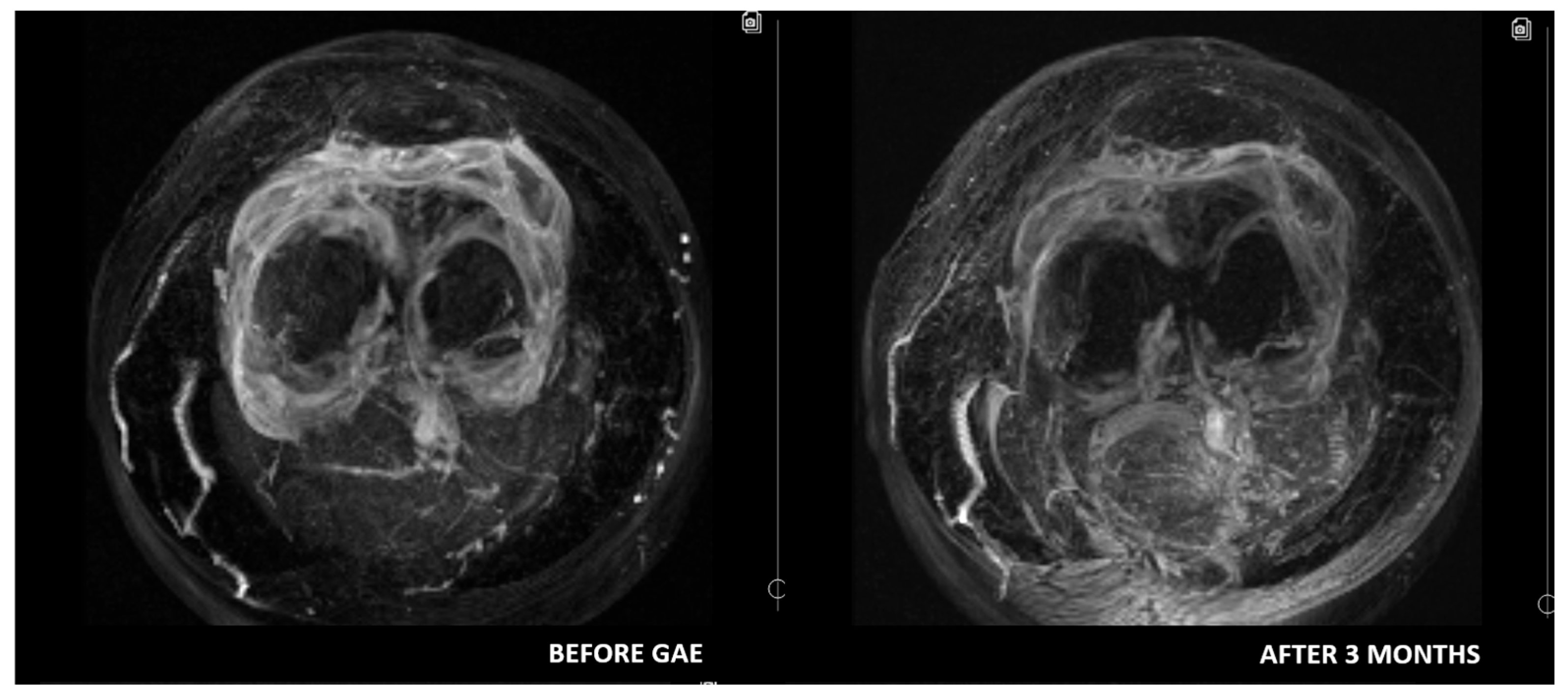 Medicina 61 00941 g002