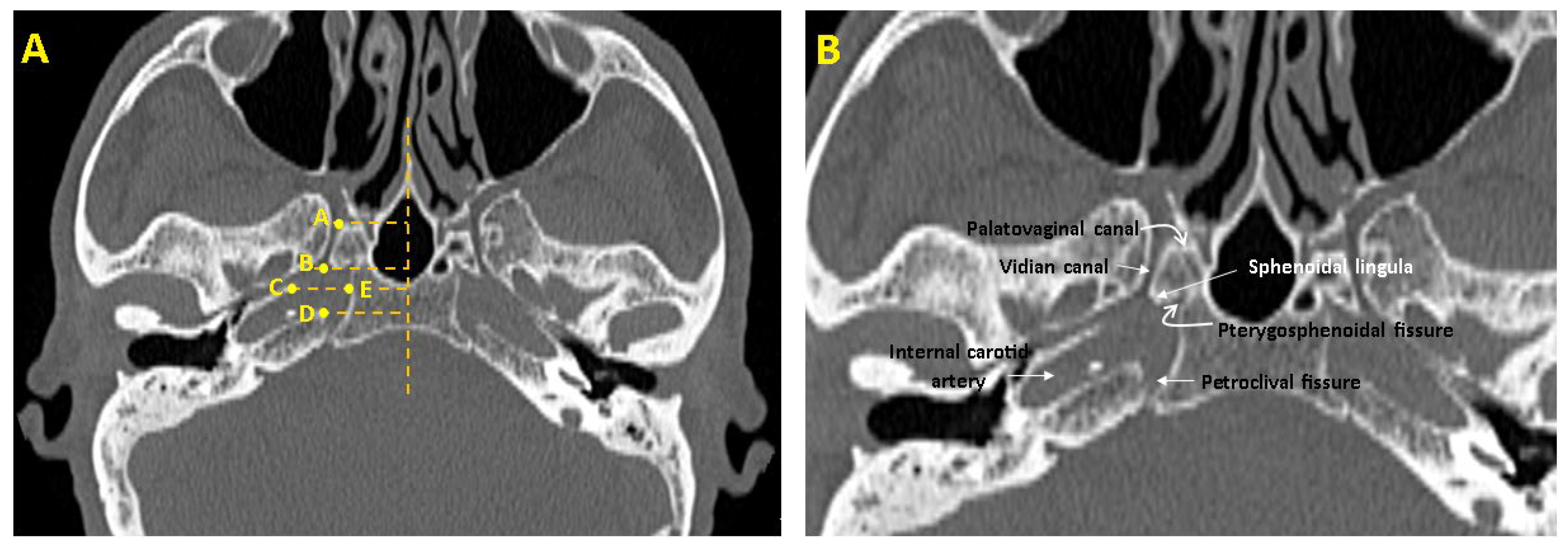 Medicina 61 00943 g001