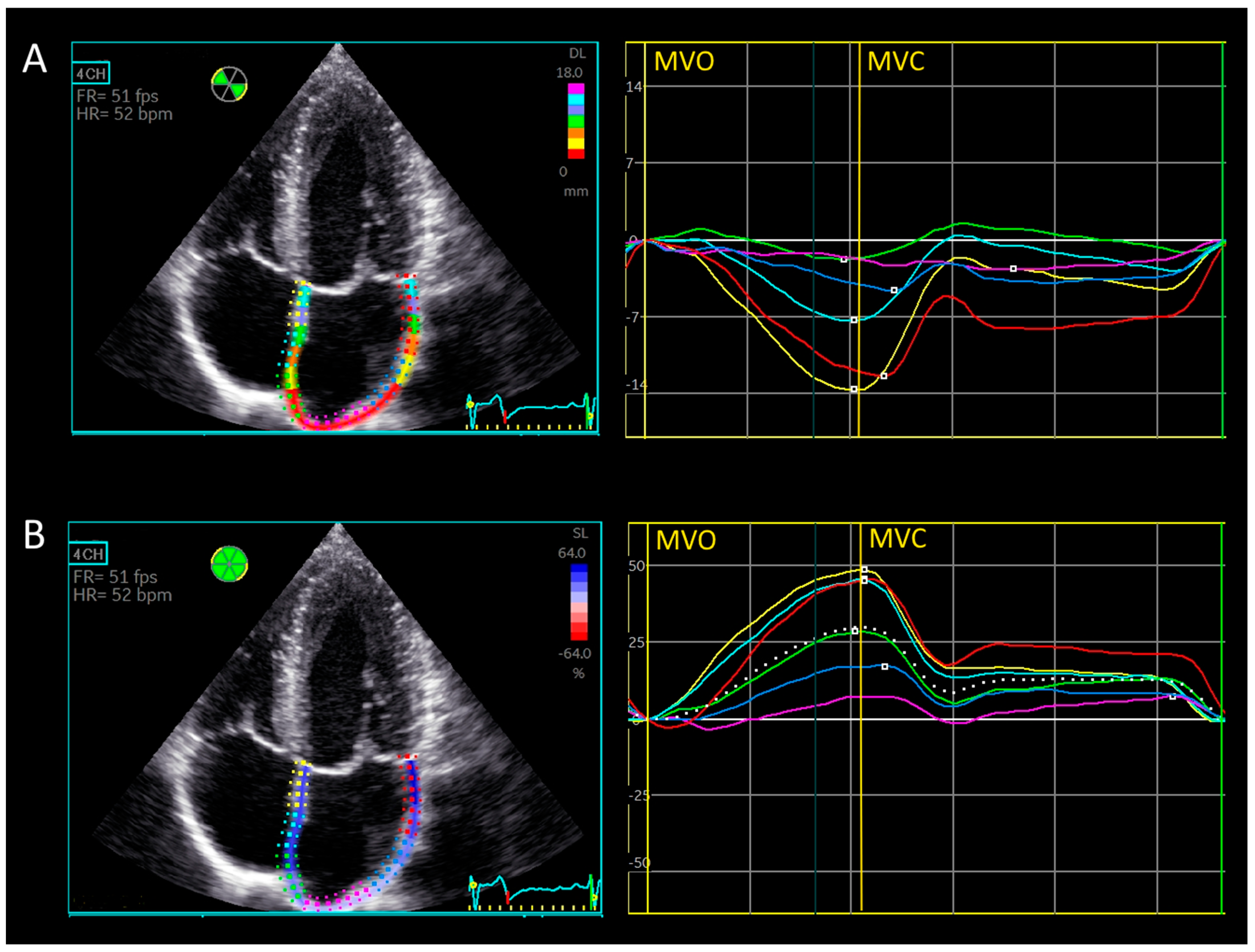 Medicina 61 00944 g002
