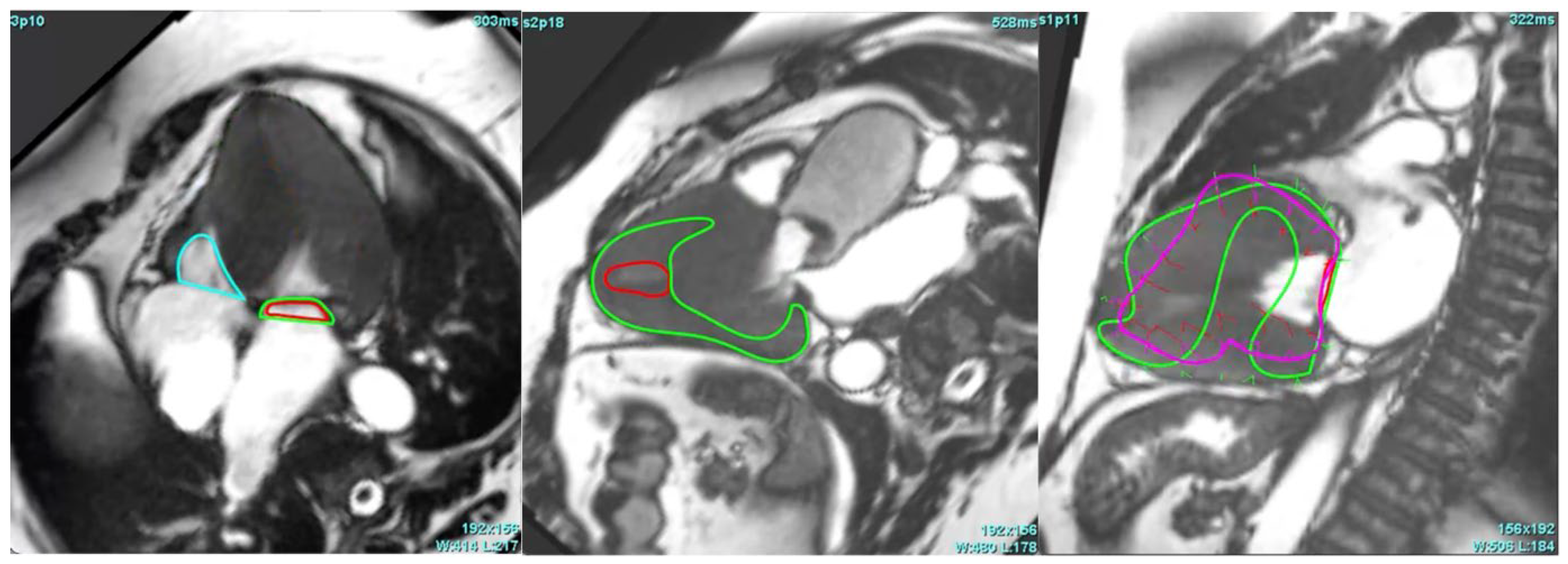 Medicina 61 00950 g002