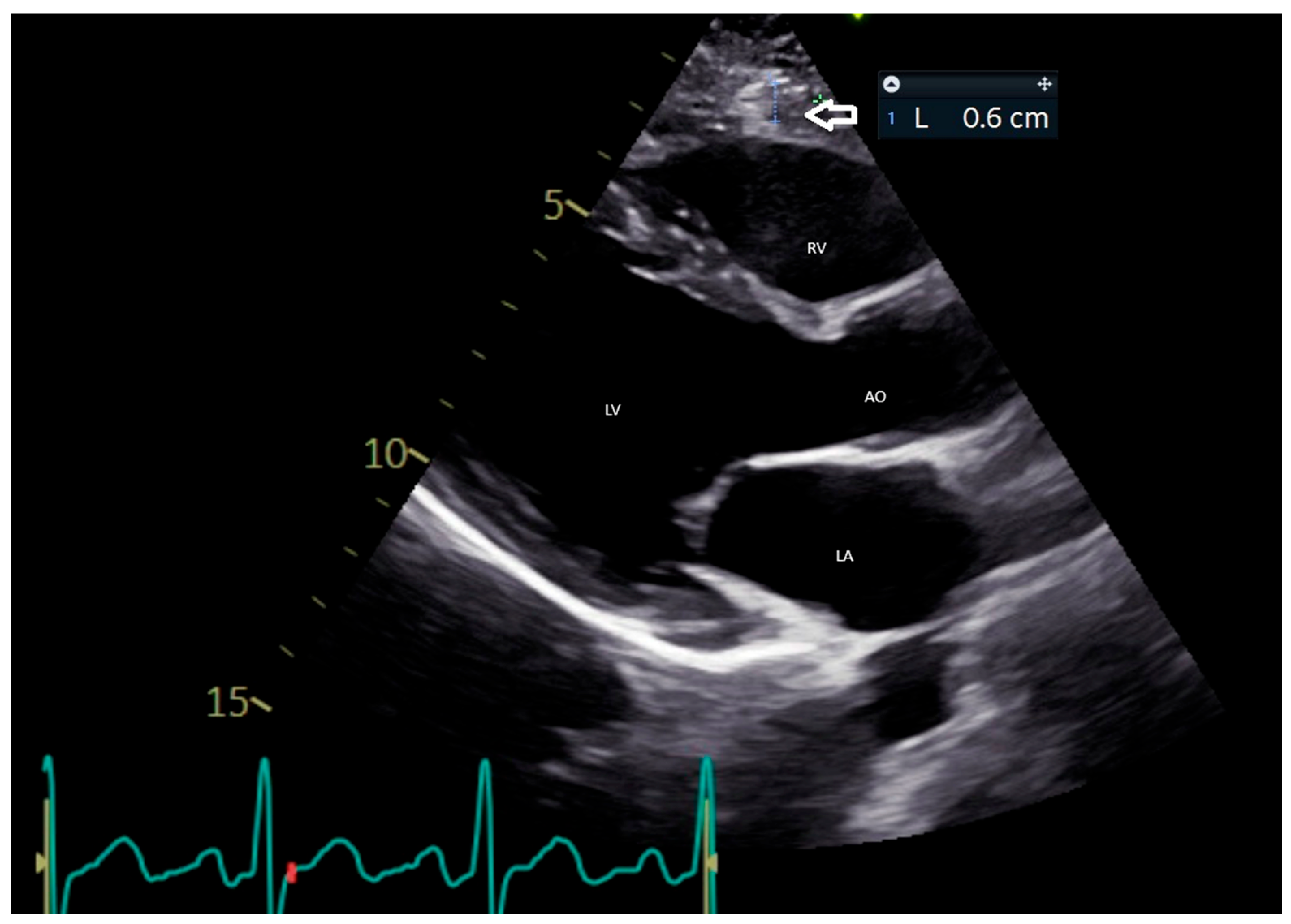 Medicina 61 00961 g001