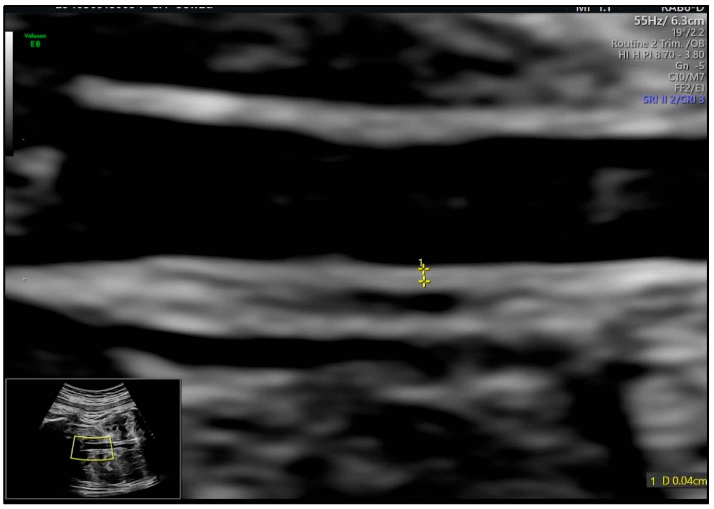 Medicina 61 00964 g001