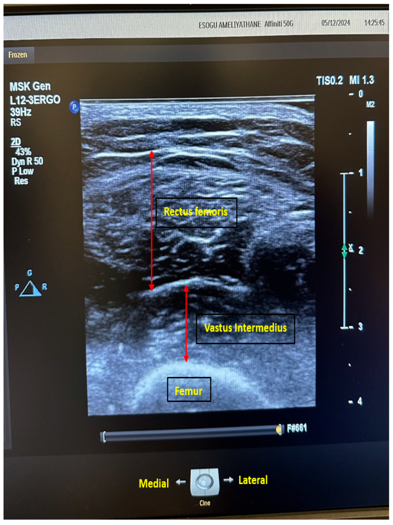 Medicina 61 00969 g002