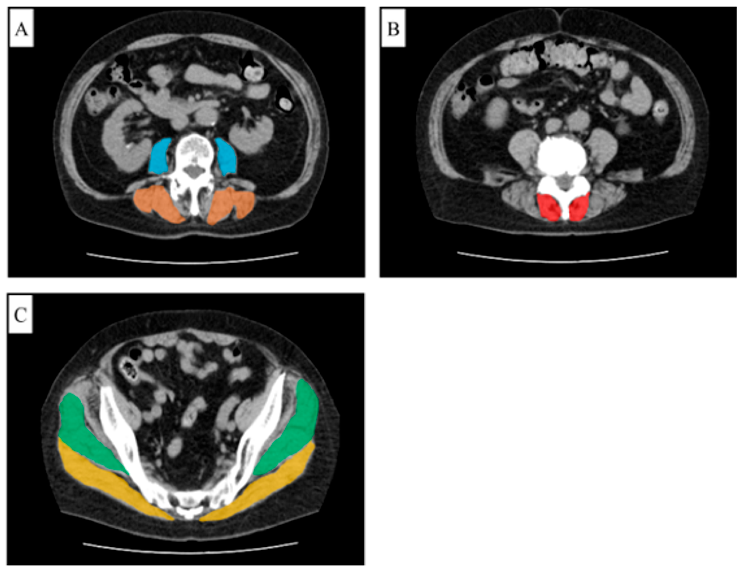 Medicina 61 00980 g002