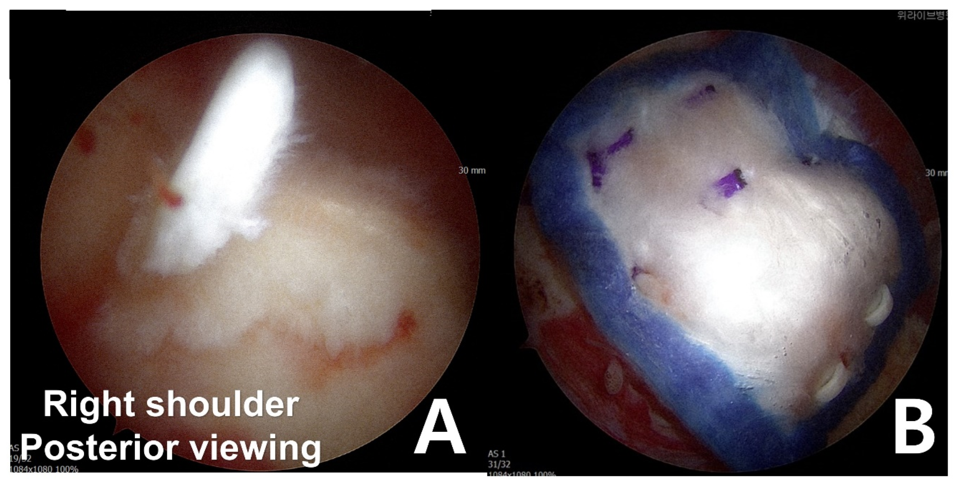 Medicina 61 00988 g002